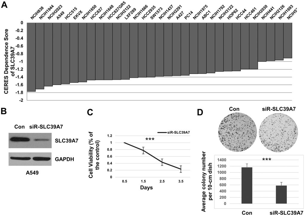 SLC39A7 played a vital role in cell survival of lung adenocarcinoma. (A) CERES values of SLC39A7 in various lung adenocarcinoma cell lines, the score less than -1 means the gene is important for cell survival. (B) After 48 h transfected with control siRNA or siRNA-SLC39A7, A549 cells were harvested. The lysates were undergone for detecting SLC39A7 by Western blotting. (C) After seeding, A549 cells were transfected with control siRNA or siRNA-SLC39A7. The CCK-8 assay was performed at 0.5, 1.5, 2.5 and 3.5 days after transfection. The cell viability of siRNA-SLC39A7 treatment was normalized to control group. (D) A549 cells were transfected with control siRNA or siRNA-SLC39A7. Then the quantitative cells were placed and cultured for 14 day, and stained with crystal violet-glutaraldehyde solution. All experiments performed in triplicate, and the results are calculated using mean ± standard deviation. One-way ANOVA or Student t test was carried out for evaluating the statistical significance between groups. *** P