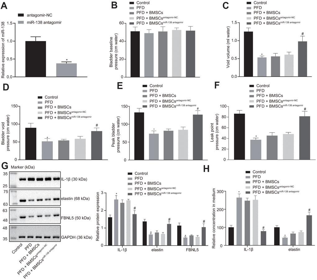 miR-138 inhibition improves results of urodynamic tests in PFD rats after BMSC transplant. (A) miR-138 expression in BMSCs treated with antagomir-NC or miR-138 antagomir evaluated by RT-qPCR; (B) basal bladder pressure level of rats in each group; (C) bladder void volume of rats in each group; (D) bladder void pressure of rats in each group; (E) peak bladder pressure of rats in each group; (F) LPP of rats in each group; (G) the protein expression of IL-1β, elastin, and FBNL5 in rats evaluated by western blot analysis; (H) the content of IL-1β and elastin in peripheral blood of rats examined by ELISA. *p vs. BMSCs treated with antagomir-NC or rats injected with saline (control rats); #p vs. PFD rats injected with BMSCsantagomir-NC; statistical data were measurement data, and described as mean ± standard deviation. The unpaired t test was conducted for comparison between two groups. The one-way ANOVA was adopted for comparison among multiple groups, followed by Tukey’s post hoc test. The experiment was repeated 3 times independently.