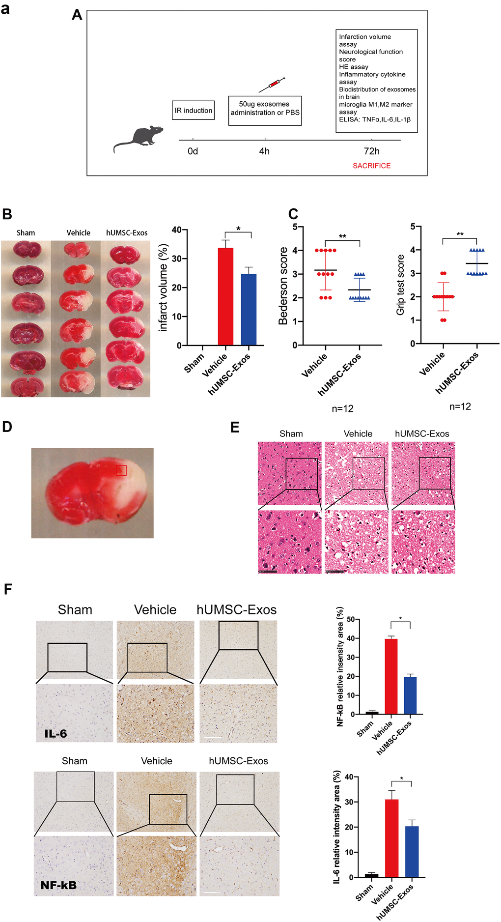 Treatment with hUMSC-Exos attenuates microglia-mediated inflammation and neurological deficits after ischemic stroke. (A) Schematic of the protocol. (B) Representative photomicrographs of TTC-stained tissue from the control, vehicle-only, and experimental groups, with associated infarct size as calculated using ImageJ software. Data are expressed as mean ± SEM (n = 12 per group). Significant differences are indicated (*p C) Neurological deficit scores in the vehicle-only and experimental groups 72 hours post-reperfusion. Data are expressed as mean ± SEM (n = 12 per group). Significant differences are indicated (*p **p D) The red box indicates the cerebral ischemic penumbra. (E) H&E staining. Scale bar: 50 μm. (F) Representative photomicrographs of IL-6 and NFκB in the ischemic penumbra 72 hours post-reperfusion, with associated relative intensities as calculated using ImageJ software. Scale bar: 50 μm. Data are expressed as mean ± SEM (n = 6 per group). Significant differences are indicated (*p 