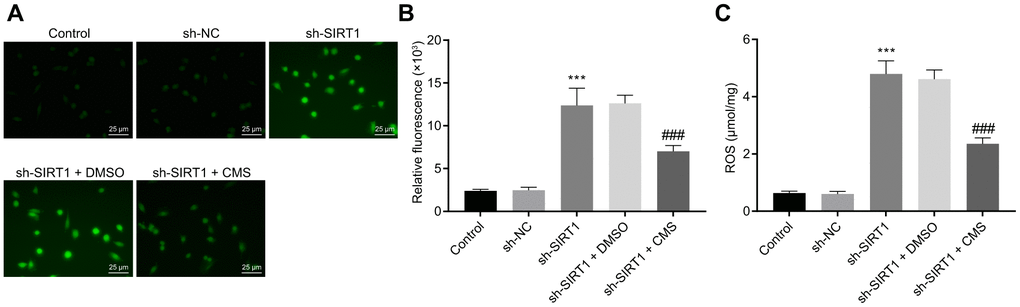 CMS decreased the level of ROS in HG-treated hRMECs. (A) Representative images of ROS shown by CM-H2DCFDA staining (green) in hRMECs treated with sh-NC, sh-SIRT1, sh-SIRT1 + DMSO and sh-SIRT1 + CMS, respectively (× 400) (scale bar = 25 μm). (B) Relative fluorescence in the hRMECs. (C) Quantitative analysis of ROS content in hRMECs. *p **p ***p #p ##p ###p 