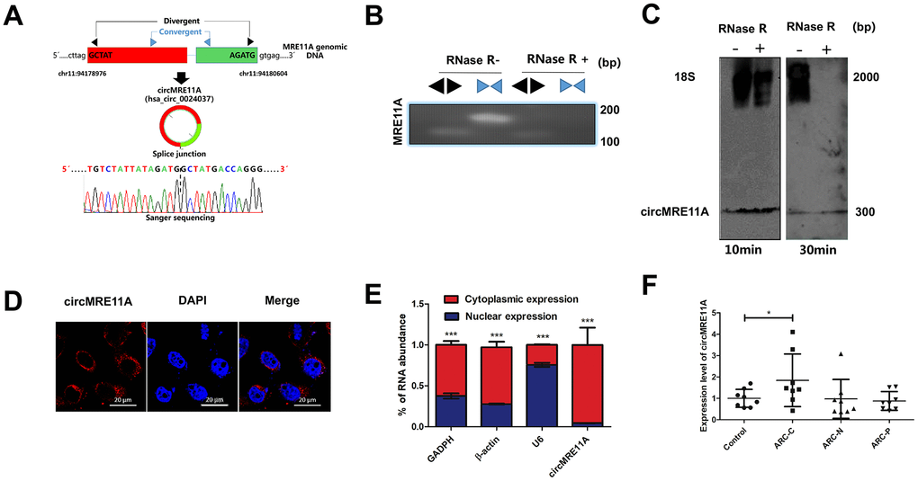 Identification of circMRE11A, a circular RNA implicated in LECs of ARC and SRA01/04 cell lines, circMRE11A was up-regulated in ARCC compared with controls. (A). Schematic illustration showed that the genomic location of circMRE11A generated from its host gene, validating by Sanger sequencing. Sanger sequencing analysis showed head-to-tail splicing junction of circMRE11A. (B). RT-PCR or PCR assay indicated the detection of circMRE11A using divergent or convergent primers from cDNA or genomic DNA (gDNA) of LECs with and without RNase R treatment (RNase R– / +). (C). Northern blot using a junction-specific the Bioth-labeled probe indicated the endogenous existence of circMRE11A treated with and without RNase R (2 U/μg) in the cell lines at 10 min or 30 min. 18S was used as a specific probe for the internal control. (D). RNA-FISH assay showed the cytoplasmic and nuclear localization of circMRE11A in SRA04/01 cells using a junction specific probe (red), with the nuclei staining with DAPI (blue). Scale bar: 20 μm. (E). qRT-PCR indicated the distribution of circMRE11A, GAPDH, β-actin and U6 in the cytoplasmic and nuclear fractions of SRA04/01 cells. U6 was treated as a nuclear control while GAPDH or β-actin was a cytoplasmic control, ***p F). qTR-PCR assays determined circMRE11A levels in LECs of ARCs (controls (n=10), ARC-C(n=10), ARC-N (n=10), ARC-P(n=10)). GAPDH was an internal control. *p 