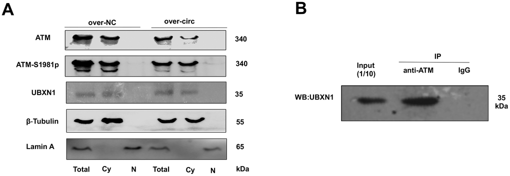 ATM or ATM-S1981p was co-localized with UBXN1 in the cytoplasm of SRA01/04 cell lines. (A). The cytoplasm and nuclei separation of proteins showed ATM, ATM-S1981p and UBXN1 were detected in cytoplasm from the over-circMRE11A group and the negative control (NC) group. We confirmed that increasing cytosolic fraction levels of ATM-S1981p but lower level of UBXN1 were detected in the over-circMRE11A group compared with the NC group. β-Tubulin as cytoplasm control, Lamin A as nuclear control, and total proteins as an internal control. (B). IP showed that UBXN1 could be precipitated by ATM in the cell lines. Input was 1/10 of total proteins as internal control.