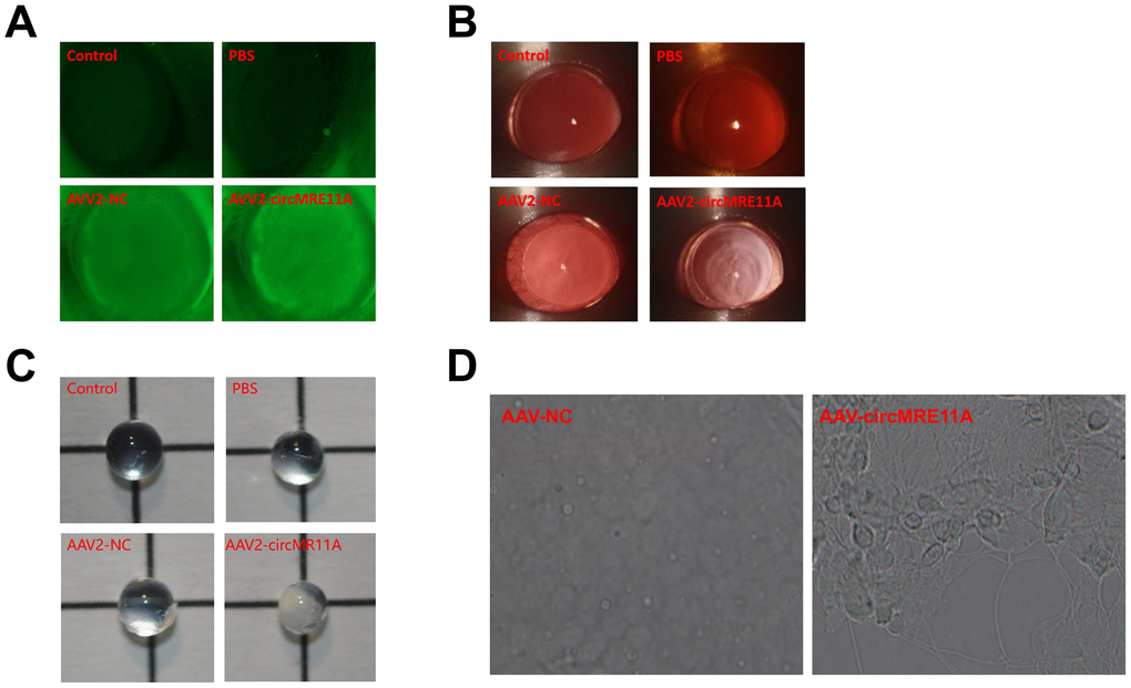 In vivo, circMRE11A-AAV2 was constructed and injected intravitreally in ICR mouse. (A). After intravitreal injection at 4 weeks, GFP-fluorescent protein encoded by circMRE11A-AAV2 or NC-AAV2 were detected in the lens of the mice under the fluorescence microscope in the circMRE11A-AAV2 group or the NC-AAV2 group compared with the control group. The results showed that circMRE11A-AAV2 had passed through lens capsule tissue and expressed in the lens of mice. (B). After intravitreal injection at 8 weeks, the opacification of lens in the circMRE11A-AAV2 group was observed compared with the control group under the slit lamp microscope. (C). Taking out the eyeball of mice, and the lens was observed under light microscope. (D). The number of SA-β-gal-positive cells increased in circMRE11A-AAV2 group compared with control group.