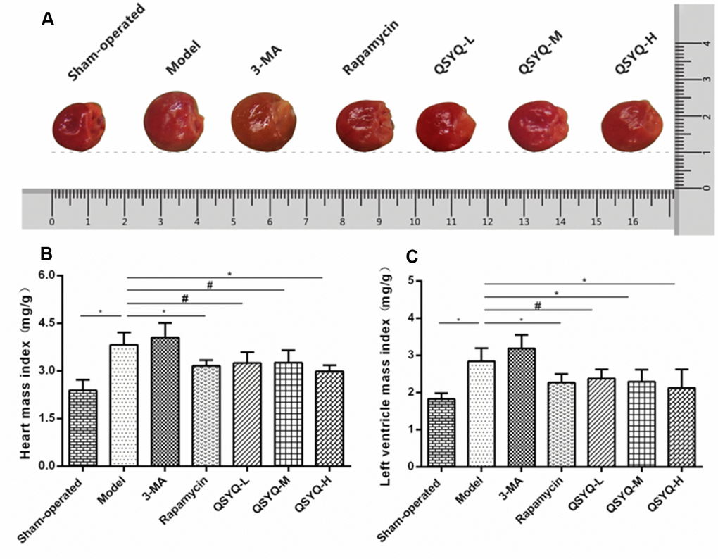 Effect of QiShen YiQi pill (QSYQ) on the general morphology of rat heart. (A) General morphology of rat heart. (B) Heart mass index of rats. (C) Left ventricular mass index of rats. Data are expressed as mean ± SD. *P#P