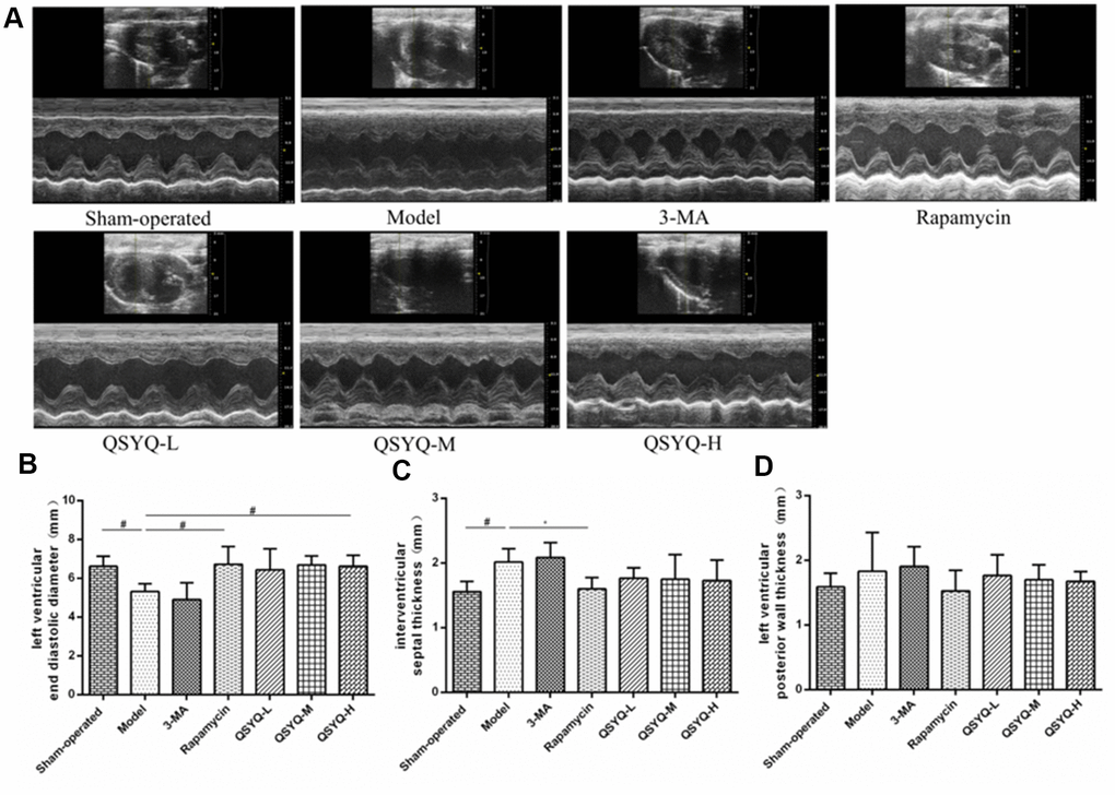 Effect of QiShen YiQi pill (QSYQ) on heart structure and function in rats. (A) Echocardiography of rat heart. (B) Left ventricular end-diastolic diameter in rats. (C) Interventricular septal thickness in rats. (D) Left ventricular posterior wall thickness in rats. Data are expressed as mean ± SD. *P#P