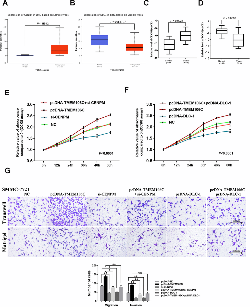 The verification of TMEM106C potentially related target genes in HCC. (A) Relative level of CENPM in normal liver and LIHC samples (UALCAN). (B) Relative level of DLC-1 in normal liver and LIHC samples (UALCAN). (C) Relative expression level of CENPM in 10 pairs of HCC samples (tumor tissues and adjacent normal liver tissues), as assessed by real-time PCR. (D) Relative expression level of DLC-1 in 10 pairs of HCC samples (tumor tissues and adjacent normal liver tissues), as assessed by real-time PCR. (E) si-CENPM (50 nM) and pcDNA-TMEM106C plasmid plus si-CENPM were transfected into SMMC-7721 cells. Every 12h, the cell number was measured by CCK8 assay. NC represents pcDNA3.1, si-NC, and blank control, which were proven to not be different from each other. 400×. P F) pcDNA-TMEM06C and pcDNA-DLC-1 plus pcDNA-TMEM06C plasmid (or no plasmid control) were transfected into SMMC-7721 cells. Every 12 h, the cell number was measured using the CCK8 assay. NC represents pcDNA3.1 and the blank control, which was proven to not be different from each other. P G) Transwell migration and invasion assays of SMMC-7721 cells after transient transfection with pcDNA-TMEM06C, si-CENPM, pcDNA-TMEM06C and si-CENPM, pcDNA-DLC-1 plus 34 pcDNA-TMEM06C plasmid (or no plasmid control). The migration and invasion cell numbers are shown in histograms (mean ± SD). NC represents pcDNA3.1, si-NC, and blank control, which were proven to not be different from each other. *P P 