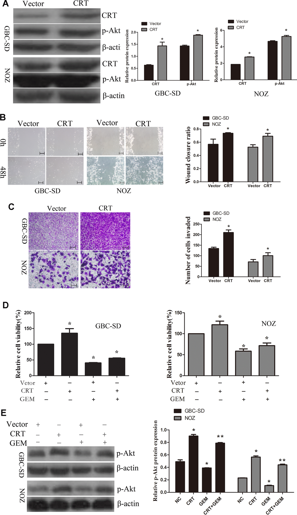 Overexpression of CRT significantly increases cell migration and decreases chemosensitivity of GBC-SD and NOZ cells to GEM. (A) CRT overexpression was confirmed by western blotting. (B) Cell migratory ability was detected by wound-healing assay. (C) Cell migratory ability was detected by Transwell assay. scale bars =200um. (D) Cell Counting Kit-8 assay was performed to analyze the proliferation of GBC-SD and NOZ cells. (E) Western blot assay suggested that p-Akt expression was involved in the chemosensitivity of GBC.*P