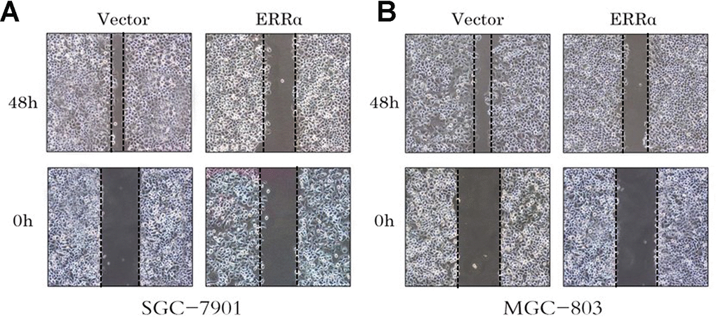 Cell wound assay indicates the cell migration of the SGC-7901 and MGC-803 cells were inhibited by the low expressed ERRα. (A) Cell wound assay indicates the cell migration of the SGC-7901 was inhibited by the low expressed ERRa; (B) Cell wound assay indicates the cell migration of the MGC-803 was inhibited by the low expressed ERRa.