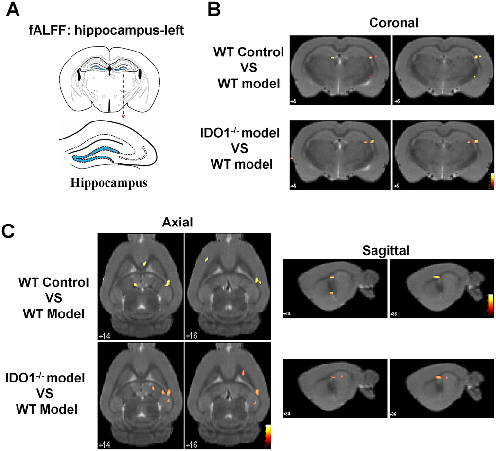 Deletion of the IDO1 retrieves hippocampal BOLD signal in mice under CUMS treatment. (A) Sketch of the hippocampus. (B, C) Images of coronal, axial and sagittal planes show the changes of BOLD–fMRI signal in the hippocampal region between different groups according to the fALFF analysis. The voxel-level height threshold was p  (uncorrected) and the cluster-extent threshold was 20 voxels.