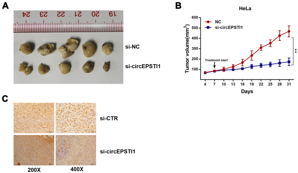 CircEPSTI1 promotes cervical cancer proliferation in vivo. (A) Tumor in the mouse xenograft model. (B) The nude mice were subcutaneously injected with HeLa cells and subjected to distinct treatments (i.e., si-cEPSTI1 or scramble). The volume curves of tumors are shown. **, P C) The immunohistochemistry analysis was performed for xenograft tumors and the representative images of ki-67 expression are presented. Scale bar = 50 μm.