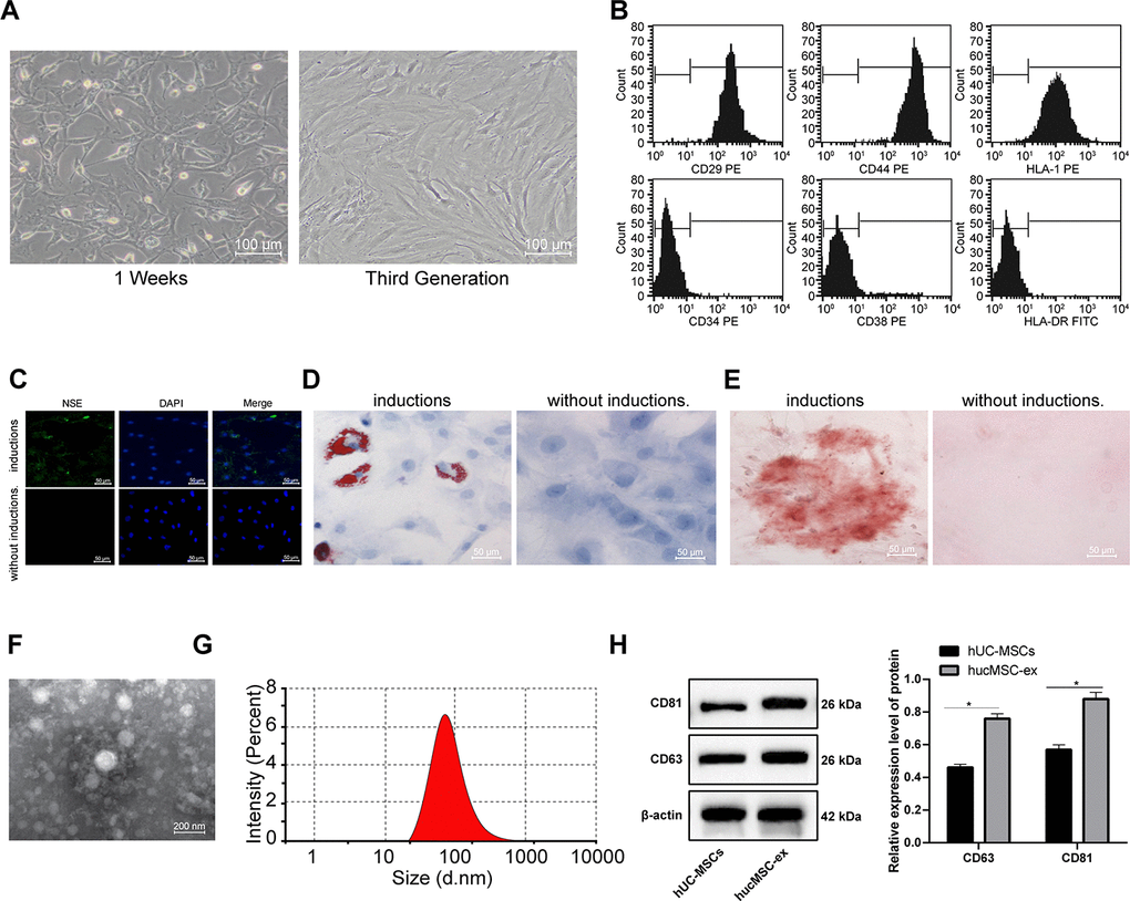 The hUCMSCs and their derived hUCMSC-ex are successfully isolated. (A) Identification of hUCMSCs after 1 week of culture and at passage 3. (B) Expression of mesenchymal cell surface markers (CD29, CD44, HLA-I, CD34, CD38 and HLA-DR) detected by flow cytometry. (C) Immunofluorescence assay detected the neurogenic induction of hUCMSCs. (D) Oil red O staining measured the adipogenic induction of hUCMSCs. (E) Alizarin red staining measured the osteogenic induction of hUCMSCs. (F) TEM observation of morphology of exosomes. (G) Particle size of exosomes calculated using ZETASIZER Nano series-Nano-ZS. (H) Protein expression of CD63 and CD81 in isolated hUCMSC-ex measured by Western blot assay. All the experiments were repeated 3 times. Data in panel (H) were analyzed by two-way ANOVA and the pairwise comparisons after ANOVA were performed with Tukey's multiple comparisons test. *p 