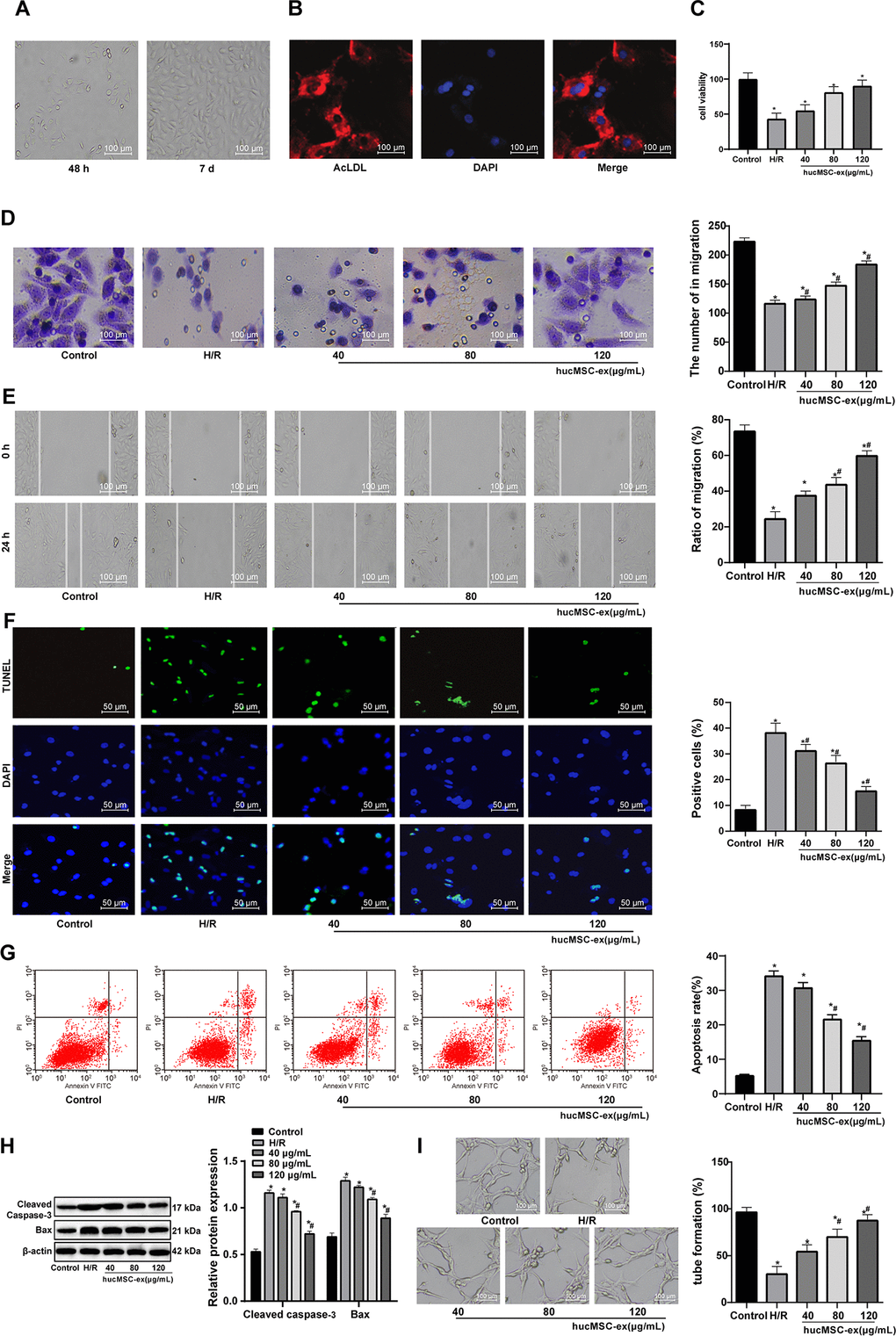 The hUCMSC-ex facilitates growth and restrains apoptosis of H/R-damaged CMECs in a concentration-dependent manner. (A) CMECs observed under microscope after 48 h (left) and at the 5-7th d (right) of cell culture. (B) Dil-ac-LDL-positive CMECs (red) and DAPI-positive (blue) under fluorescence microscope after 7 d of cell culture. (C) Viability of CMECs detected by CCK-8 after co-culture with hUCMSC-ex. (D) Invasion of CMECs assessed by Transwell assay after co-culture with hUCMSC-ex. (E) Migration of CMECs evaluated by scratch test after co-culture with hUCMSC-ex. (F) The number of TUNEL-positive CMECs after co-culture with hUCMSC-ex. (G) Apoptotic rate of CMECs assessed by flow cytometry after co-culture with hUCMSC-ex. (H) Expression of apoptosis-related proteins Cleaved caspase3 and Bax in CMECs after co-culture with hUCMSC-ex measured by Western blot assay. (I) Tube formation in CMECs after co-culture with hUCMSC-ex. *p vs. the control group; #p vs. the H/R group. All experiments were repeated 3 times. Data in panels (C–G, I) were analyzed by one-way ANOVA, and data in panel (H) were analyzed by two-way ANOVA, and the pairwise comparisons after ANOVA were performed with Tukey’s multiple comparisons test.