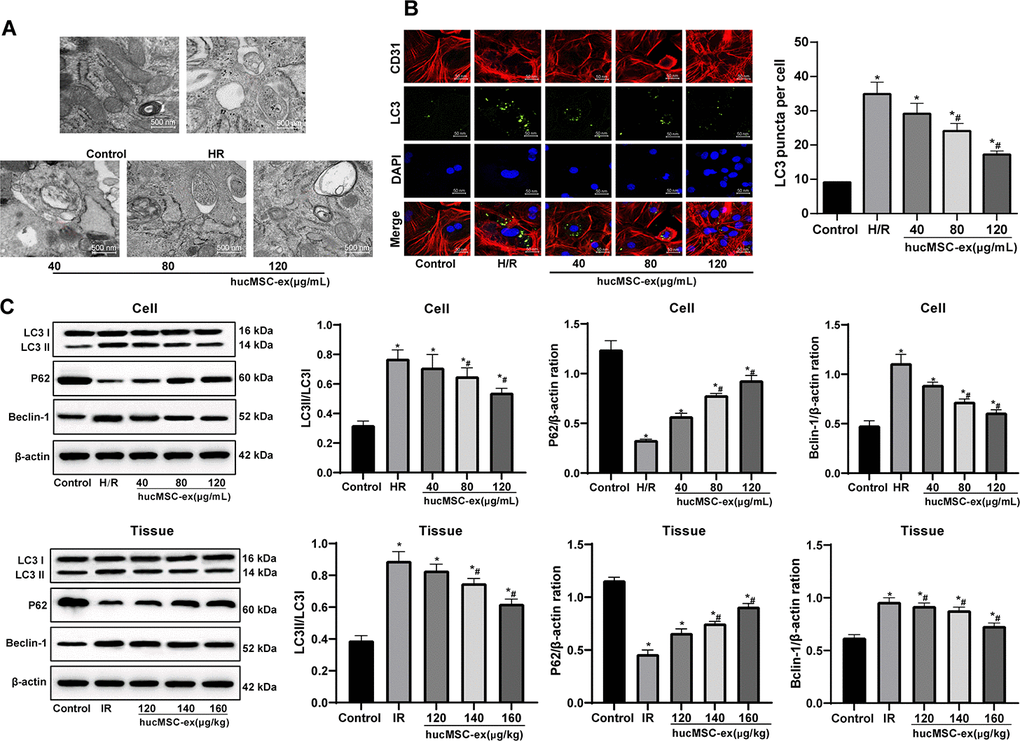 The hUCMSC-ex protects CMECs against autophagy following H/R injury. (A) Transmission electron microscope observation of autophagosomes; (B) Fluorescence localization of LC3 in CMECs under exposure to H/R injury. LC3 was labeled as green fluorescence, nucleus were labeled by DAPI and CMEC marker CD31 was labeled as red fluorescence. (C) LC3-II/LC3-I, Beclin-1 and p62 expression in CMECs under exposure to H/R injury measured by Western blot assay. *p vs. the control group; #p vs. the H/R or I/R group. All experiments were repeated 3 times. Data in panels (B and C) were analyzed with one-way ANOVA and Tukey’s multiple comparisons test.