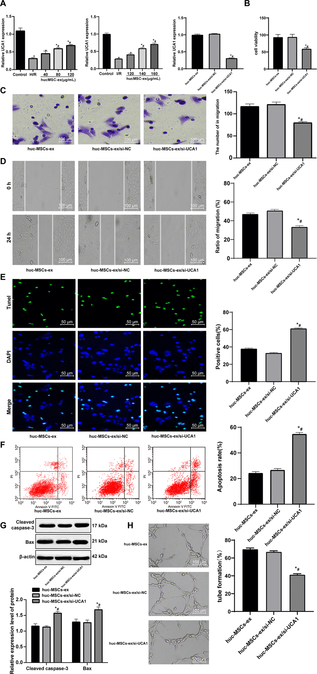 LncRNA UCA1 silencing in hUCMSC-ex facilitates H/R injury in CMECs. (A) LncRNA UCA1 expression in CMECs determined by RT-qPCR; (B) Viability of CMECs detected by CCK-8. (C) Invasion of CMECs assessed by Transwell assay. (D) Migration of CMECs evaluated by scratch test after co-culture with hUCMSC-ex. (E) The number of TUNEL-positive CMECs. (F) Apoptotic rate of CMECs assessed by flow cytometry. (G) Expression of apoptosis-related proteins Cleaved caspase3 and Bax in CMECs measured by Western blot assay. (H) Tube formation in CMECs. *p vs. the control or hUCMSCs-ex group; #p vs. the H/R group. All experiments were repeated 3 times. Data in panel (G) were analyzed with two-way ANOVA, and data in other panels were analyzed with one-way ANOVA, followed by Tukey’s multiple comparisons test.