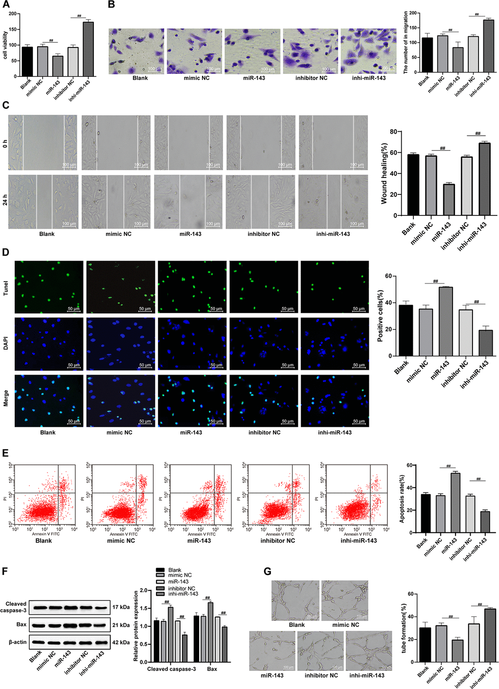 The hUCMSC-ex protects CMECs against H/R injury. (A) Viability of CMECs transfected with miR-143 mimic or inhibitor detected by CCK-8. (B) Invasion of CMECs transfected with miR-143 mimic or inhibitor assessed by Transwell assay. (C) Migration of CMECs transfected with miR-143 mimic or inhibitor evaluated by scratch test. (D) The number of TUNEL-positive CMECs transfected with miR-143 mimic or inhibitor. (E) Apoptotic rate of CMECs transfected with miR-143 mimic or inhibitor assessed by flow cytometry. (F) Expression of apoptosis-related proteins Cleaved caspase3 and Bax in CMECs transfected with miR-143 mimic or inhibitor measured by Western blot assay. (G). Tube formation in CMECs transfected with miR-143 mimic or inhibitor.*p vs. the control group; #p vs. the H/R group. All experiments were repeated 3 times. Data in panel (F) were analyzed with two-way ANOVA, and data in other panels were analyzed with one-way ANOVA, followed by Tukey’s multiple comparisons test.