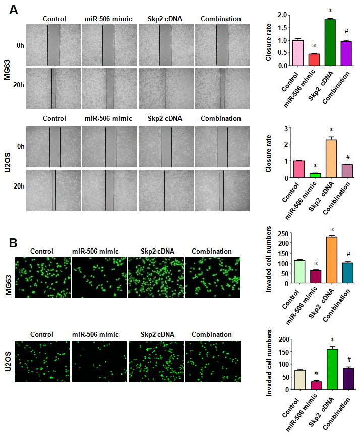 Skp2 overexpression rescues miR-506-induced inhibition of motility. (A) Left: Wound healing assay was done in osteosarcoma cells after miR-506 mimic transfection and Skp2 upregulation. Right: Quantitative results of migration. *p #PB) Left: Invasion was examined by Transwell assay in osteosarcoma cells after miR-506 mimic transfection and Skp2 upregulation. Right: Quantitative results of invasion.