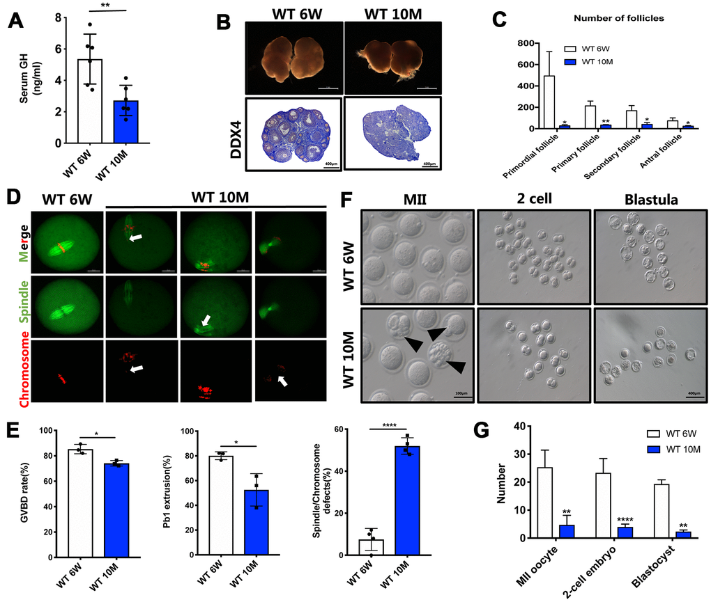 The GH levels and oocyte quality were declined in aged mice. (A) The GH levels in the peripheral blood were measured in young (n = 6) and aged (n = 6) mice. (B) Micrographs of young and aged WT mouse ovaries (Scale bar, 1 mm) and HE staining of these ovaries (Scale bar, 100μm, 500 μm). (C) Follicle counts in 6-week (n = 3) and 10-month (n = 3) old WT mice. (D) Chromosomes misalignment and spindle defects (arrowheads) in aged oocytes. The oocytes were stained with α-tubulin (green) and propidium iodide (PI) (red) respectively. Scale bar, 50 μm. (E) Left: The rate of GVBD and Pb1 extrusion were recorded after 4 h and 14 h of culture in M2 medium respectively. Right: Percentages of oocytes with spindle defects in young (n = 97) and aged mice (n = 104). (F) Representative images of MII oocytes collected from young (n = 76) and aged (n = 19) mice and IVF outcomes from these two groups. Black arrowheads point to abnormal oocytes. Scale bar, 100 μm, 400 μm. (G) Quantification of MII oocytes, 2-cell embryo and blastocyst from young and aged mice. Data are presented as mean ± SD. *P P P 