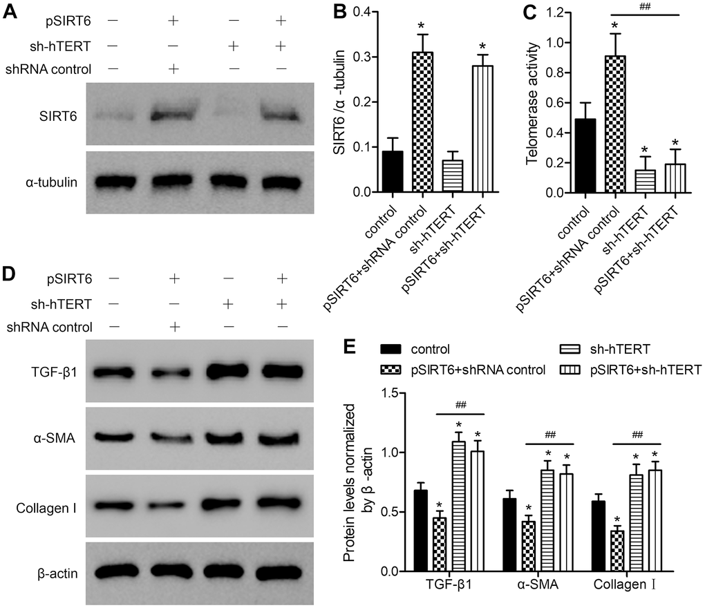 The impact of SIRT6 overexpression on telomerase activity and fibrosis-related protein expression is reversed by hTERT knockdown. LFH cells were infected using lentiviral vectors encoding SIRT6 (pSIRT6), an hTERT-specific shRNA (sh-hTERT), or a control shRNA, after which Western blotting was used to assess the expression of SIRT6 in these cells (A, B), with α-tubulin being used for normalization. (C) Telomerase activity in ligamentum flavum cells treated as indicated was assessed based upon optical density. (D, E) TGF-β1, α-SMA, and collagen I protein levels were analyzed by western blotting, with β-actin being used for normalization. Data are means ± SD of three replicates. *pp