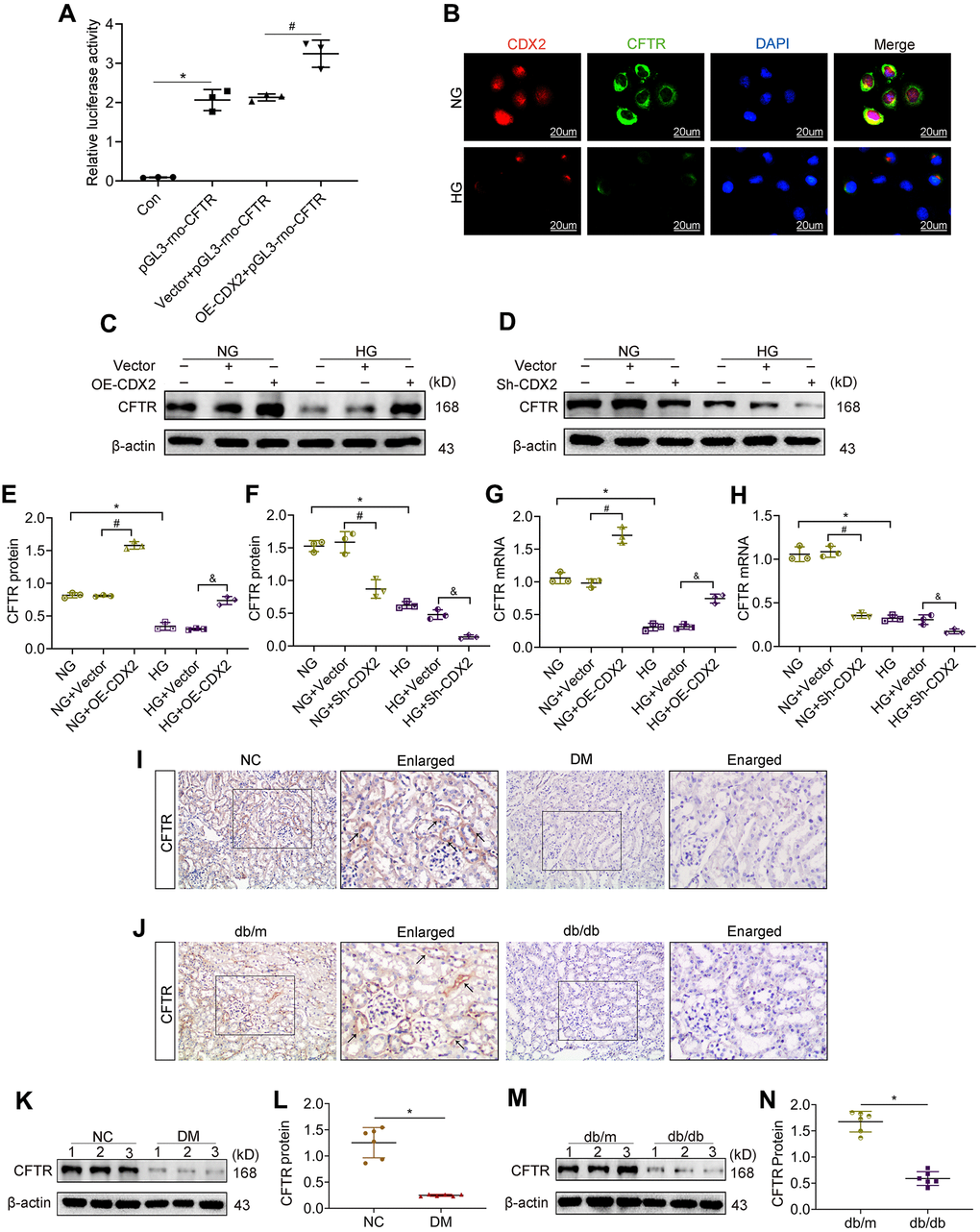 CFTR is a downstream target gene of CDX2, and downregulated in DKD. (A) CFTR promoter activity increased in CDX2-overexpressing NRK-52E cells. NRK-52E cells were administered non-transfected (Con)/pGL3-rno-CFTR-promoter plasmid (pGL3-rno-CFTR), or co-transfected with CDX2-overexpressing/Vector plasmid and pGL3-rno-CFTR-promoter plasmid. n=3; *P#PB) Immunofluorescent staining of CDX2 and CFTR in NRK-52E cells of the NG and HG groups, respectively (scale bar, 20μm). C-H Western blot bands (C, D) and protein quantitation (E, F) of CFTR in non-transfected (NG or HG treated) NRK-52E cells, and NRK-52E cells transfected with Vector (NG+Vector, HG+Vector), CDX2-overexpressing (NG+OE-CDX2, HG+OE-CDX2) or CDX2-knockdown (NG+Sh-CDX2, HG+Sh-CDX2) plasmid, and mRNA levels (G, H). Data are mean±SD from three experiments performed independently. n=3; *P#P&PI, J) Immunohistochemical staining of CFTR in T1D model mice and controls (J), T2D mice and controls (J). n=6; *PK, L) Western blot bands of CDX2 in T1D model mice and controls (K), and quantitative data (L). (M, N) Western blot bands of CFTR in T2D model mice and controls (M), and quantitative data (N). Data are mean±SD from three independent assays. n=6; *P