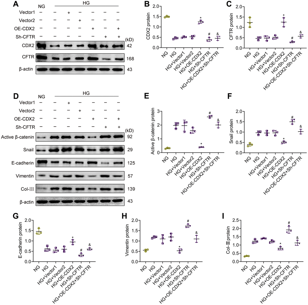 CFTR knockdown abolishes the effects of CDX2 on resisting hyperglycemia-induced RTECs injury. NRK-52E cells were, respectively, non-transfected (NG group or HG group), and transfected with CDX2-overexpressing / Vector1 (HG+OE-CDX2 group / HG+Vector1 group) or CFTR-knockdown / Vector2 plasmid (HG+Sh-CFTR group / HG+Vector2 group), or co-transfected CDX2-overexpressing + CFTR-knockdown plasmid (HG+OE-CDX2+Sh-CFTR group). (A–C) Immunoblot bands of CDX2 and CFTR, and quantitative data (B, C). (D–I) Immunoblot bands of activated β-catenin, Snail, E-cadherin, Vimentin, and Col-III; quantitative data are shown (E–I). Data are mean±SD from three experiments performed independently. n=3; *P#P&P