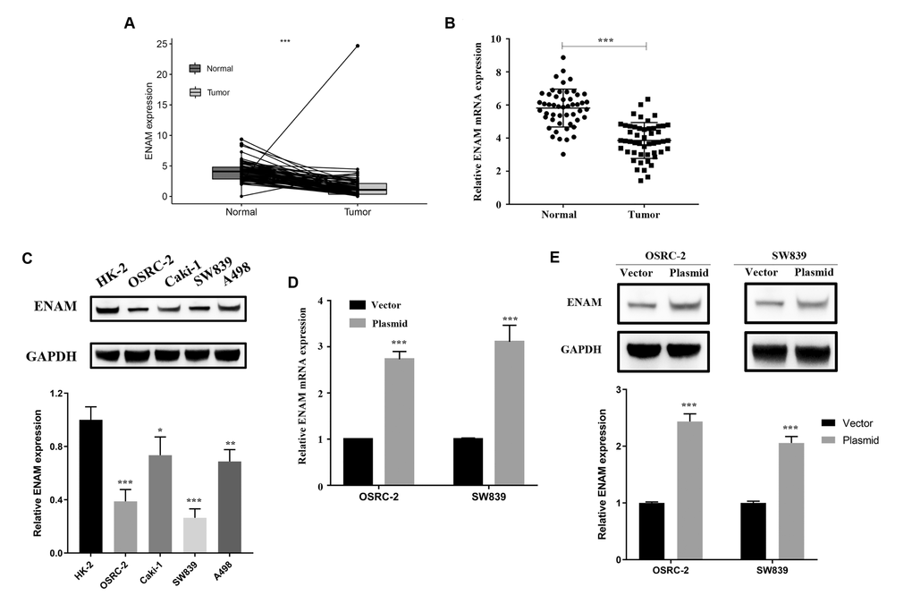 ENAM is down-regulated in ccRCC. (A) Expression of ENAM was down-regulated in 72 paired tumor compared with paratumor samples in TCGA; (B) Expression of ENAM was frequently down-regulated in 50 ccRCC tumor tissue; (C) ENAM protein expression in HK-2, OSRC-2, SW839, Caki-1 and A498 cell lines; (D) qPCR of indicated cells transfected with ENAM-vector and ENAM; (E) Western blotting of indicated cells transfected with ENAM-vector and ENAM. Abbreviations: NS: P>0.05; *: P