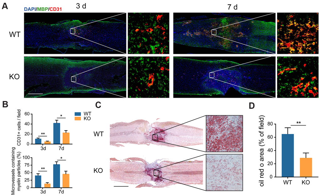 The clearance of myelin debris is reduced in the GIT1 KO mice after SCI. (A) IF staining of myelin debris marker MBP (green) and MECs marker CD31 (red) at the injury core of the GIT1 WT and KO mice at 3 and 7 days after SCI. Nuclei were stained using DAPI (blue). Bar = 500 μm. (B) Quantification of CD31-postive MECs and myelin-containing MECs in the injury sites at day 3 and 7 post-SCI. (C) Oil Red O images at day 7 post-SCI. Bar = 2000 μm. (D) Quantification of the ORO stained positive areas in the GIT1 WT and KO groups. N = 6 animals per group. *p **p 