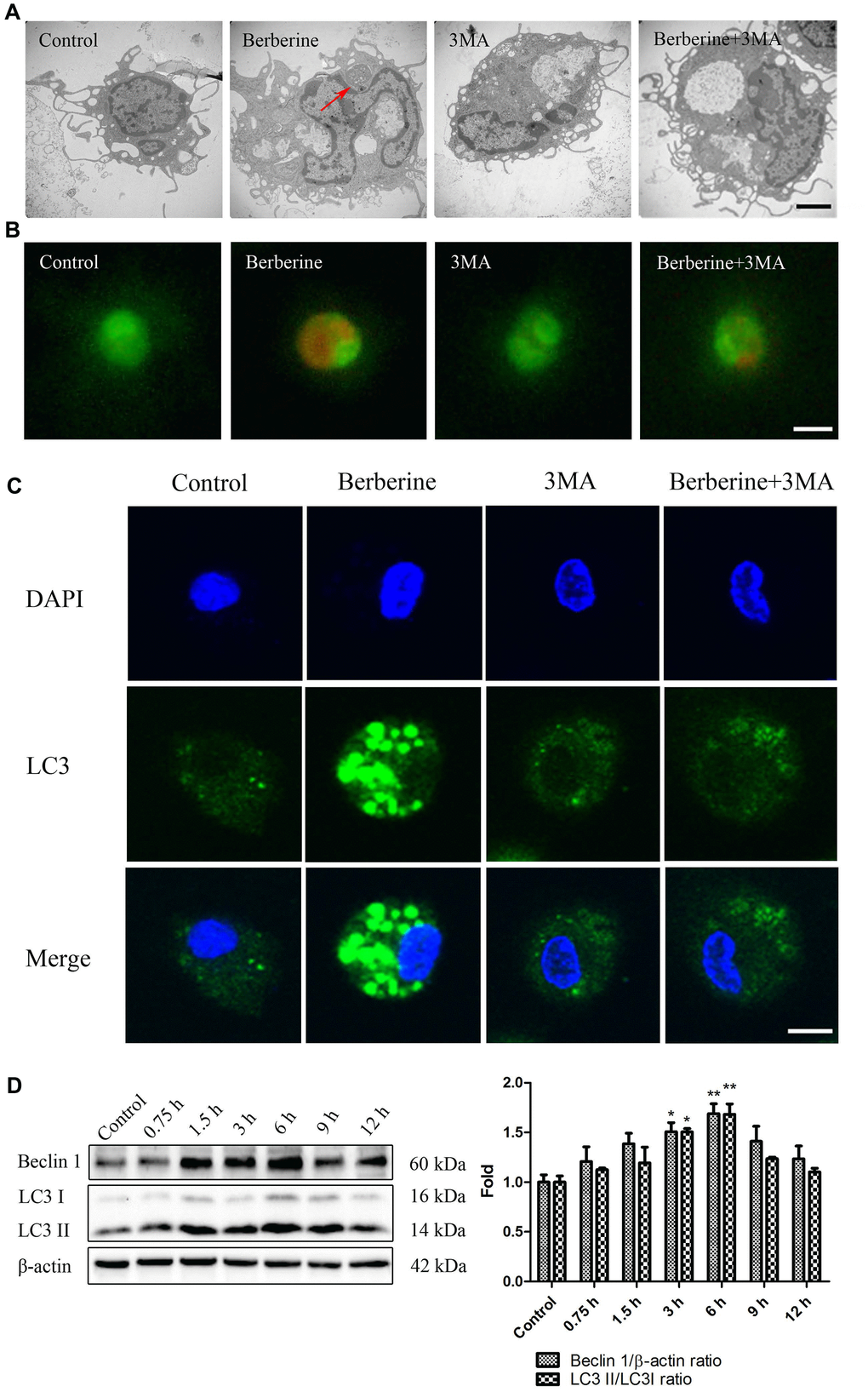 Berberine triggers autophagy in peritoneal macrophages. (A) Ultrastructural changes in untreated (control), 3MA only, and berberine-treated with or without 3MA peritoneal macrophages were observed by TEM at 6 h after berberine treatment. Red arrows indicate autophagosomes. Scale bar, 2 μm. (B) Peritoneal macrophages in control, 3MA only, and berberine-treated with or without 3MA groups incubated with acridine orange (50 μM) for 30 min. Scale bar, 50 μm. (C) Peritoneal macrophages stained with an anti-LC3B antibody and DAPI at 6 h after berberine treatment. Scale bar, 25 μm. (D) The expression of LC3 I, LC3 II, and Beclin 1 was analyzed by western blotting after treatment with berberine (100 μmol/L) for different time intervals. Data was analyzed by one-way ANOVA with Tukey HSD post-hoc test (vs. Control group). All values are expressed as mean ± SD (error bars) of three independent experiments. n = 3; *p **p 