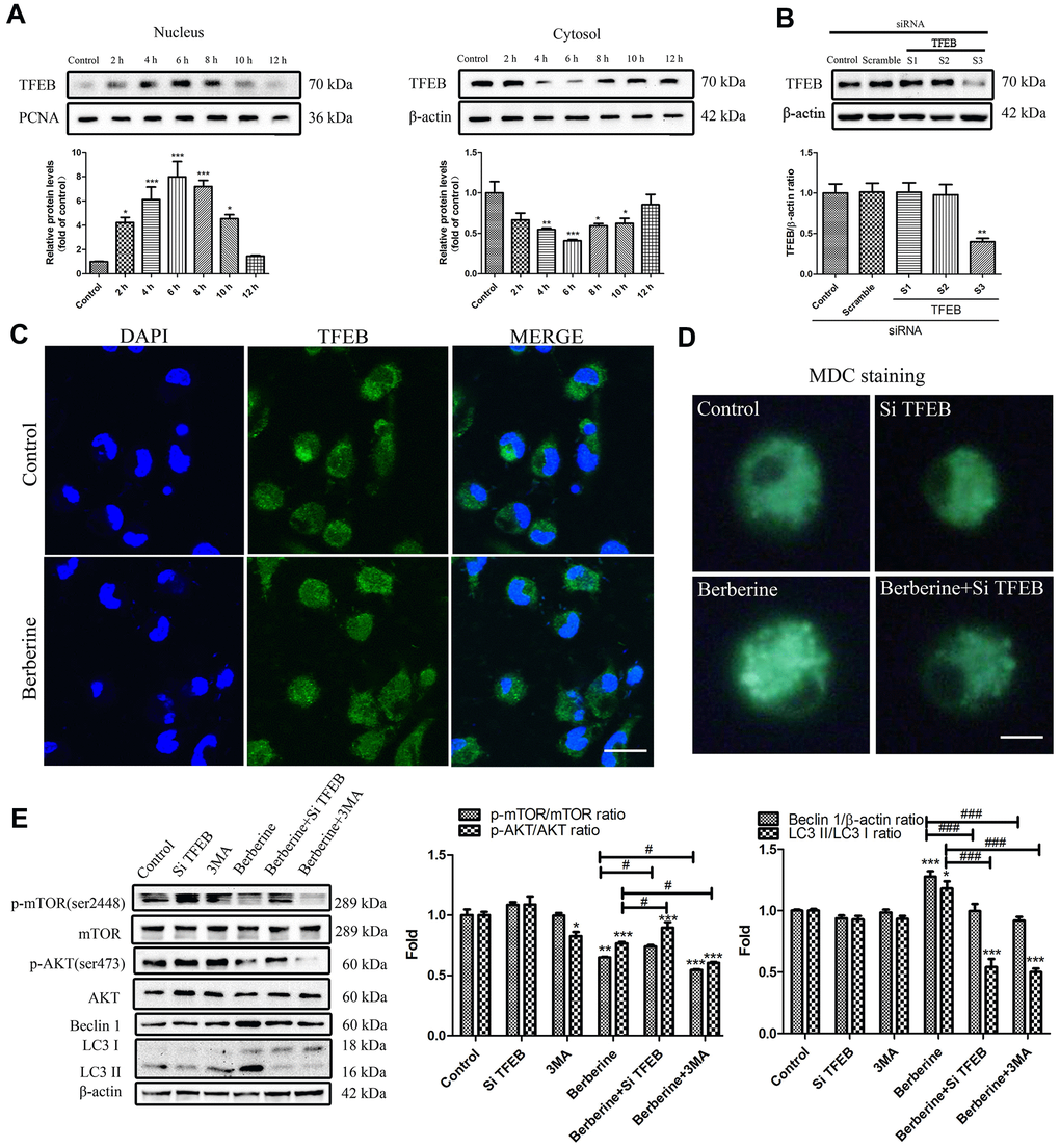 Berberine-induced TFEB nuclear translocation promotes autophagy. (A) The expression of TFEB in the nucleus and cytoplasm after treatment with berberine at different time points was detected by western blotting. Data was analyzed by one-way ANOVA with Tukey HSD post-hoc test (vs. Control group). (B) Representative western blots and quantification of TFEB following siRNA treatment. Data was analyzed by one-way ANOVA with Tukey HSD post-hoc test (vs. Control group). (C) Western blotting and immunofluorescence analysis of the effects on TFEB translocation on peritoneal macrophages at 6 h after treatment with berberine. Scale bar, 100 μm. (D) Formation of AVOs was detected by MDC staining after different treatments of peritoneal macrophages. Scale bar, 20 μm. (E) The expression of autophagy pathway proteins and autophagy-related proteins was detected by western blotting in peritoneal macrophages after different treatments. Data was analyzed by one-way ANOVA with Tukey HSD post-hoc test (vs. Control group). Analysis of variance and Student-Newman-Keuls post hoc tests were used to compare two group (vs. berberine group). All values are expressed as mean ± SD (error bars) of three independent experiments. n = 3; *p **p ***p #p ###p 