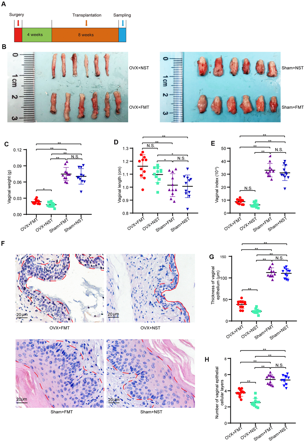 Fecal transplantation relieves vaginal atrophy in OVX+FMT mice. (A) The timeline of fecal transplantation and sample collection for OVX+NST and OVX+FT mice. (B) Representative images for isolated vagina of OVX+FMT, OVX+NST, Sham+FMT and Sham+NST group. (C) Vaginal weight (one-way ANOVA, F3,40=101.07, PD) Vaginal length (one-way ANOVA, F3,40=8.68, PE) Vaginal index (vaginal weight/body weight*10-4) (one-way ANOVA, F3,40=129.36, PF) Representative of eosin and hematoxylin staining for vagina of OVX+NST, OVX+FT, Sham+FMT and Sham+NST group mice (magnification 200x), the area delineated by the red dotted line denotes the epithelial layer of the vagina. (G) Average vaginal epithelial thickness of the respective OVS+NST, OVS+FT, Sham+FMT and Sham+NST groups (one-way ANOVA, F3,40=278.45, PH) Average number of vaginal epithelial cellular layers of the OVX+NST group and the OVX+FT group (one-way ANOVA, F3,40=74.19, PP P 