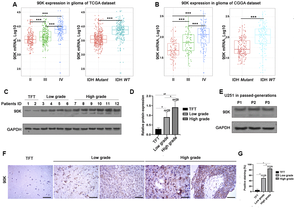 Relationship between 90K expression and the clinical features of glioma. The mRNA expression of 90K in glioma with different WHO grade and IDH status in the TCGA dataset (A) and CGGA dataset (B). Both datasets revealed 90K expression was higher in high grade glioma vs low grade; higher in IDH wildtype vs mutant (A, B). Protein expression pattern of 90K in glioma tissues, which showed 90K protein level was significantly increased in high grade glioma (C, D). Protein expression of 90K was stable in GBM cell line U251 by serial passaging. (E). Histological investigation via IHC staining also showed that 90K expression level significantly associated with pathological diagnosis and progression (F, G). * indicates p value 