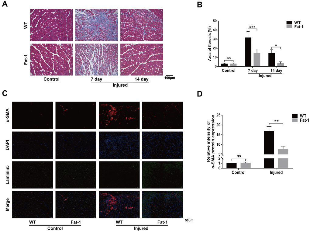 High endogenous n-3 PUFA levels reduce inflammation response to cardiotoxin-induced muscle injury in fat-1 mice. (A) Representative images show Masson's trichrome staining of the gastrocnemius muscle sections from fat-1 and wild-type mice on days 7 and 14 days after CTX-induced injury. Scale bar = 100 μm. (B) Quantitative data for the fibrosis area. (C, D) Representative immunofluorescence images and quantitative analysis show α-SMA protein expression in the gastrocnemius muscle tissues from fat-1 and wild-type mice on day 7 after CTX-induced injury. Scale bar = 50 μm. Data were expressed as the mean ± SD (n = 4-5). NS, non-significant; * P P P 