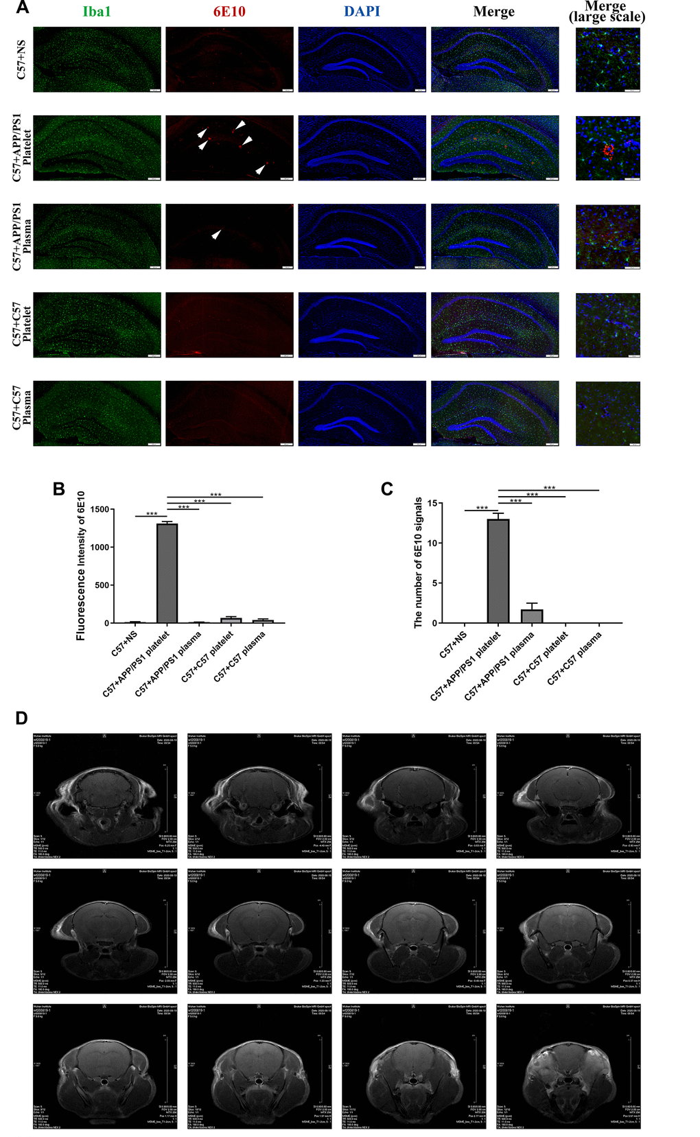 Effects of tail vein injection of plasma or platelets on AD related indexes of blood and brain tissue in mice. (A) IF staining of brain slices with anti-Iba1 (green) and anti-6E10 (red) antibodies, and the nucleus was stained with DAPI (blue). The arrow indicates the expression of 6E10, which labels the Aβ protein. (B) Fluorescence intensity of 6E10. (C) The number of 6E10 signals. Each group contained 8 mice, and 6 similar coronal sections were selected from each brain for IF staining. Scale bars: high-magnification images = 50 μm, other images = 200 μm. ***PD) Brain image of a C57 mouse by MRI.