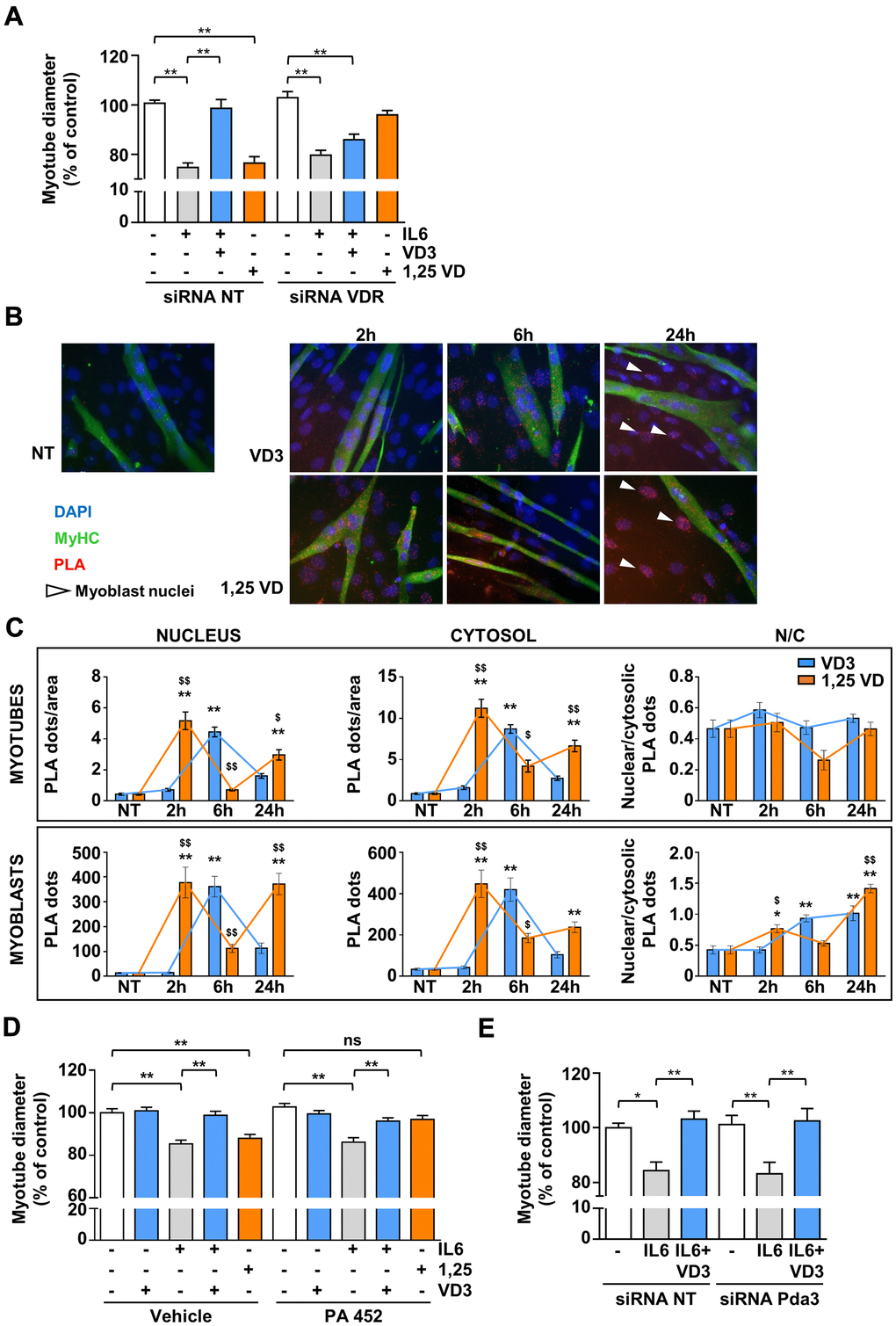 VDR, but not RXR nor 1,25D3-MARRS (Pdia3), mediates VD3 anti-atrophic activity. (A) C2C12 myotubes were transfected with non-targeting or Vdr specific siRNAs. 24 h after silencing, C2C12 myotubes were treated with 20ng/mL IL6 in the absence or presence of 100 nM VD3 or with 100 nM 1,25VD, and myotube diameters were measured after further 24 h. (B) Representative images of the PLA-detected complexes of VDR and RXR (red) in C2C12 myotubes (green) treated for the indicated times with 100 nM VD3 or 100 nM 1,25VD. Nuclei were stained with DAPI. The white arrows indicate the nuclei of bone fide residual undifferentiated myoblasts. (C) Quantification of the PLA dots in myotubes (top) or myoblasts (bottom), in nuclei (left), cytoplasm (middle), and their ratio (right). (D) Myotube diameters of C2C12 treated with 20ng/mL IL6, with or without 100 nM VD3, or with 100 nM 1,25VD, in the presence/absence of 2.5 μM RXR inhibitor PA 452. (E) C2C12 myotubes were transfected with non-targeting or Pdia3 specific siRNAs, treated with 20ng/mL IL6 in the absence or presence of 100 nM VD3 and analyzed after further 24 h. Data are presented as the mean ± SEM. *P P P $P $$P 