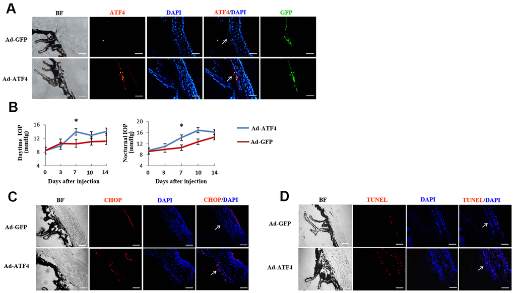 Activation of ATF4 in mice TM induces apoptosis and increase of intraocular pressure. ATF4 adenoviral vectors or GFP adenoviral vectors as control were injected into the anterior chamber of 6~8 weeks old C57BL/6J mice. (A) Visualization of the GFP fluorescence (green) of adenovirus in mice TM after anterior chamber injection for 24 h and increased ATF4 fluorescence (red) could be seen in the ATF4 adenovirus injected eye (Ad-ATF4) compared to the control (Ad-GFP). (B) Intraocular pressure (IOP) of the mice was measured day (left) and night (right) before and after anterior chamber injection. IOP was markedly elevated in the Ad-ATF4 group (n = 8) compared to the control (Ad-GFP) (n = 7) 7 days after the injection, *PC) Immunofluorescent staining of the iridocorneal angle showing increased expression of CHOP (red) in the TM of Ad-ATF4 group after anterior chamber injection for 7 days (n = 3). (D) TUNEL staining of the iridocorneal angle 7 days after anterior chamber injection (n = 3). Arrows mark the TM. Blue, nuclear staining with DAPI. BF, bright field. TM, trabecular meshwork. Scale bar, 50 μm.