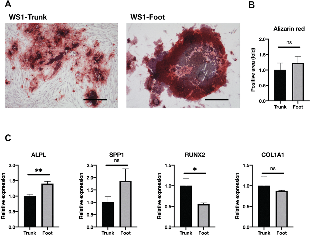 Osteogenesis was maintained in both groups. (A) Representative images of Alizarin red staining two weeks after induction of osteogenesis in the trunk and foot fibroblasts of WS1. Bar = 300 μm. (B) Quantification of relative stained area with Alizarin red. Data are means ± SEM of two patients with four microscopic views. For statistical analysis, student t-test was performed (ns, not significant). (C) Relative gene expression analyzed by qRT-PCR. Data are means ± SEM of two patients with three technical replicates. For statistical analysis, student t-test was performed (ns, not significant; *p