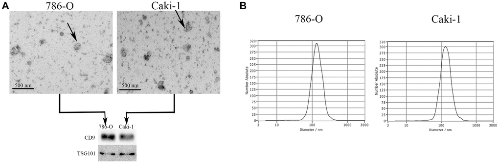 Characterization of EVs derived from RCC cells. (A) Representative EVs were analyzed via electron microscopy, and expression of the EV markers CD9 and TSG101 was assessed via Western blotting. (B) A NanoSight analysis was used to measure EV particle size distributions. The average particle diameters ranged 85.8–201.8 nm and 83.7–201.6 nm for EVs derived from 786-O and Caki-1 cells, respectively.
