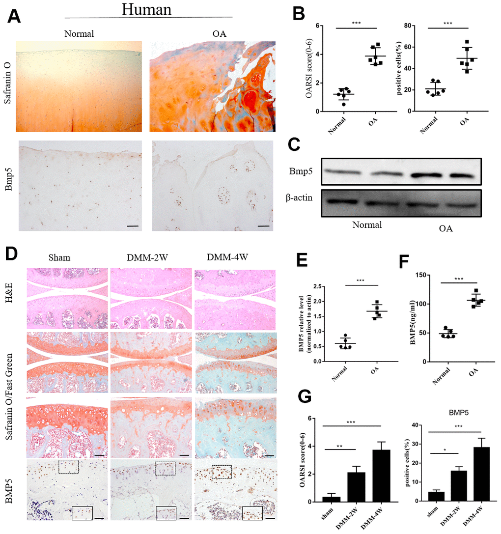 Bmp5 is overexpressed in knee articular cartilage tissues of OA patients. (A) Representative images show Safranin O-Fast Green staining and BMP5 immunohistochemical staining in the knee articular cartilage tissues from healthy subjects and OA patients (n=6 each). Scale bar: 10 μm. (B) OARSI scores based on the histochemical staining and corresponding BMP5 immunohistochemical staining of human knee articular cartilage tissue sections from healthy and osteoarthritis patients. (C) Representative western blots show BMP5 protein expression in the knee articular cartilage samples from healthy individuals and OA patients. (D) Representative images show Safranin O-Fast Green staining and BMP5 immunohistochemical staining in the knee articular cartilage sections from sham, DMM-2W and DMM-4W model mice (n=5 each). Scale bars: 10 μm (first line) and 5 μm (others). (E) Representative western blots show the levels of BMP5 protein in the knee articular cartilage sections from sham, DMM-2W and DMM-4W model mice. (F) ELISA assay results show joint fluid BMP5 levels in the healthy and OA patients. (G) BMP5 immunohistochemical staining scores and OARSI scores of the DMM-2W, DMM-4W, and sham model mice are shown. All data are represented as means ± SD.