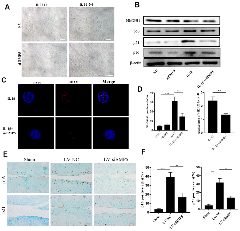 BMP5 knockdown inhibits in vitro and in vivo chondrocyte senescence in the in vitro and in vivo OA models. (A) The SA-β gal staining assay results in IL-1β-treated control and BMP5 knockdown murine chondrocytes. (B) Representative western blots show the levels of HMGB1, p53, p16, and p21 proteins in IL-1β-treated control and BMP5 knockdown murine chondrocytes. (C) Representative immunofluorescence images show γH2AX (red) staining in control and BMP5 knockdown murine chondrocytes treated with IL-1β. The chondrocytes were counterstained with DAPI (blue), a DNA binding dye. (D) Quantitative analyses show SA-β gal staining assay and γH2AX (red) staining in treated as above. (E, F) Representative immunohistochemical staining and quantitative analysis of p16 and p21 expression in the knee articular cartilage tissues from sham-operated, DMM plus LV-siNC, and DMM plus LV-siBMP5 groups of mice at 4 weeks post-DMM operation. All data are represented as the means ± SD (n=5); scale bars: 5 μm; **P