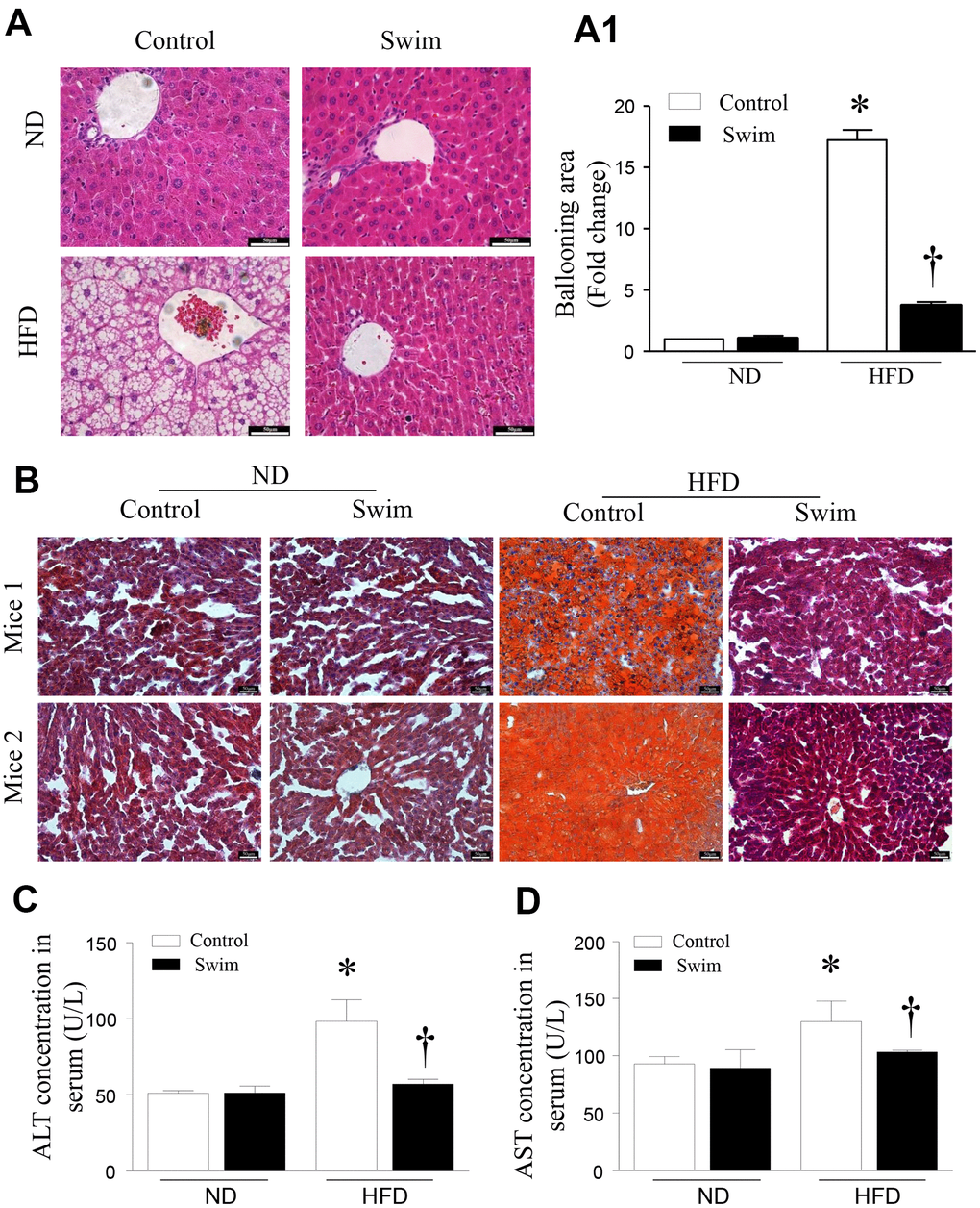 Exercise ameliorated liver histological changes and steatosis. (A) Hepatic steatosis and ballooning area (A1) determined by H&E and (B) Oil Red O staining for hepatic fat (scale: 50 μm). (C, D) The serum levels of ALT and AST in mice induced by HFD. Data are presented as mean ± SD, n = 6. * P 