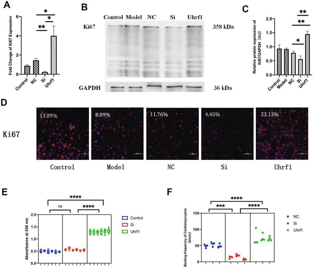 The effect of Uhrf1 on cell cycle and viability in myocardial ischemia-reperfusion injury. (A) The relative mRNA expressions of Ki67 in Myocardial ischemia-reperfusion model in vitro were determined by qRT-PCR. (B) Western blot was used to detect the expression level of Ki67 protein in each group. GAPDH serves as a loading control. (C) Expression of Ki67 protein relative to GAPDH data from 3 biological repeats is shown. (D) Detection of Ki67 protein expression and semi quantitative analysis by immunofluorescence microscopy (x200). Scale bar, 100μm. (E) The cardiomyocytes viability in knockdown and overexpression Uhrf1 groups was detected by CCK8. (F) The beating times per minute of cardiomyocytes in overexpression and knockdown group. Data shown are mean ± SD. *P P P P in vitro oxidative stress model; NC, negative control of RNAi; si, RNAi knockdown of Uhrf1; Uhrf1, Uhrf1 overexpression.