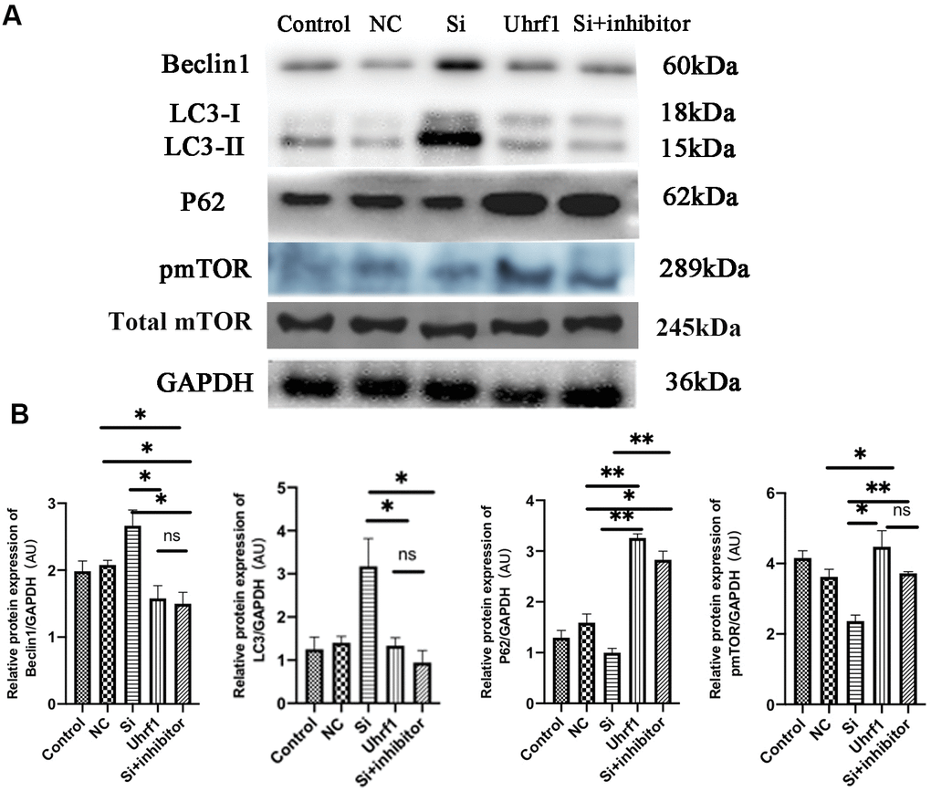 The regulation of mTOR on autophagy in MIRI. (A) Western blot was used to detect the expression level of Beclin1, LC-3, P62, total m-TOR and p-mTOR protein. GAPDH serves as a loading control. (B) Expression of Beclin1, LC-3, P62 and p-mTOR protein relative to GAPDH data from 3 biological repeats is shown. Data shown are mean ± SD. *P P P P in vitro oxidative stress model; NC, negative control of RNAi; si, RNAi knockdown of Uhrf1; Uhrf1, Uhrf1 overexpression.
