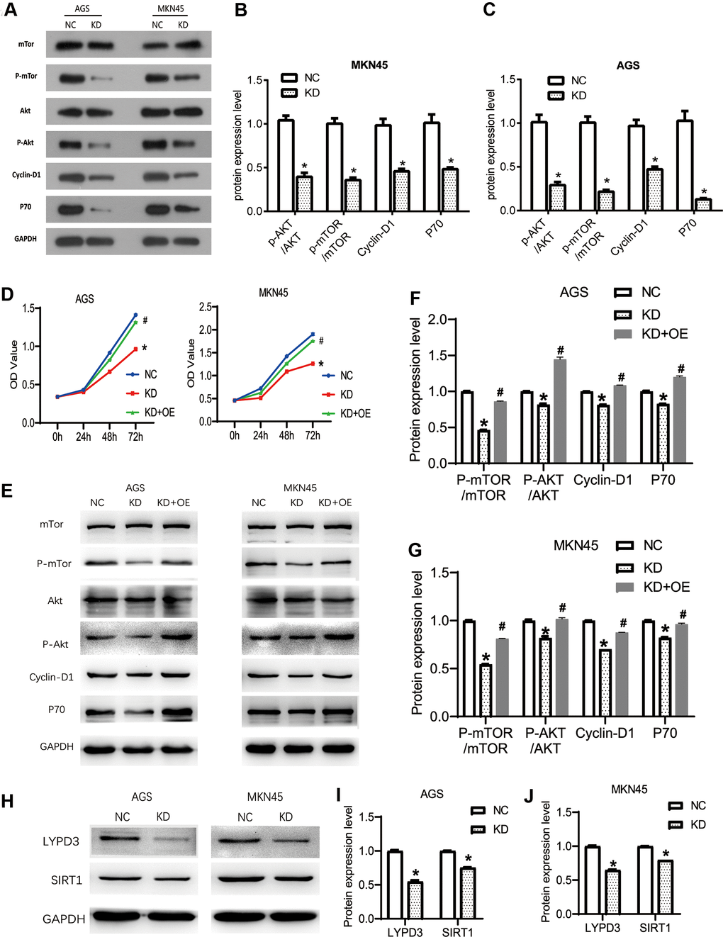 The knockdown of OGFRP1 inhibited tumor progression by activating the AKT/mTOR pathway in human gastric cancer cells. (A) The activities of AKT/mTOR pathway-related proteins were analyzed using western blot. Statistical analysis of protein expression levels in MKN45 (B) and AGS (C) cells were performed using the t-test. (D) OGFRP1 overexpression plasmid was transfected into OGFRP1 knockdown cells (KD+OE group). CCK8 was performed to detect the proliferation of MKN45 and AGS cells. (E) The levels of AKT/mTOR pathway-related proteins were detected by western blot in AGS (F) and MKN45 (G) cells. (H) The expression levels of LYPD3 and SIRT1 were detected by western blot in AGS (I) and MKN45 (J) cells. *P