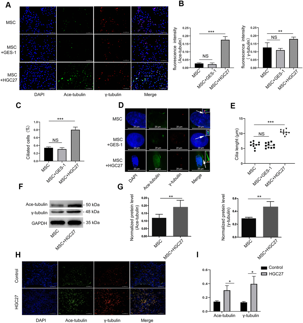 HGC27 but not the GES-1 increased the cilia formation of MSCs. (A) Immunofluorescence analysis of primary cilia in MSC, MSC+GES-1, MSC+HGC27. Primary cilia were stained with acetylated α-tubulin (axoneme, green) and γ-tubulin (basal body, red) antibody. Scale bars, 100 μm. (B) Quantitative analysis of the fluorescence intensity of immunofluorescence in (A). (C) Quantitative evaluated the number of cilia on an equal area (n=3, at least 200 cells). (D) Representative images of primary cilia in MSCs. The inset shows a high-power image of the basal body and axoneme. Primary cilia are stained with acetylated α-tubulin (axoneme, green) and γ-tubulin (basal body, red) antibodies. DAPI staining is used as nuclear counterstaining (blue). Scale bars, 20 μm. (E) Graphical representation of cilia length in the MSC, MSC+GES-1, and MSC+HGC27 groups (n=10). (F) Western blot analysis of acetylated α-tubulin and γ-tubulin expression in MSCs with or without co-cultured HGC27. (G) Quantitative analysis of acetylated α-tubulin and γ-tubulin protein levels from immunoblots in (F). Acetylated α-tubulin and γ-tubulin protein levels were normalized to GAPDH (n=3). (H) Femur tissues of C57BL mice injected with PBS or HGC27 cells at 90 days post-injection are stained for γ-tubulin (red), acetylated α-tubulin (green), and nuclei (blue). Scale bar, 100 μm. (I) Quantitative analysis of the fluorescence intensity in (H). Data are shown as mean±SEM. Statistical differences were obtained using Student's t-test, *, p