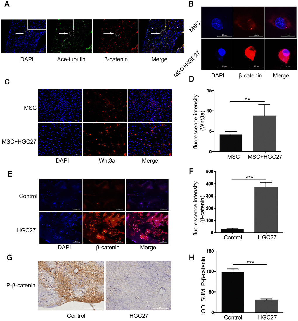 Gastric cancer activates the canonical Wnt/β-catenin signaling pathway in bone. (A) Immunofluorescence analysis of acetylated α-tubulin (ciliary axonin, green) and β-catenin (red) in femur from PBS injected C57BL mice. DAPI (nuclear marker, blue) staining was used as counterstain. Scale bars, 100 μm. (B) Immunofluorescence staining of MSCs with or without co-cultured HGC27 to visualize β-catenin (red) and nuclei (DAPI, blue) states. Scale bar, 20 μm. (C) Immunofluorescence staining of MSCs with or without co-cultured HGC27 showing Wnt3a (red) and nuclei (blue). Scale bar, 100 μm. (D) Quantification of immunofluorescence intensity in (C). (E) Representative femoral tissues from C57BL mice injected with PBS or HGC27 were analyzed for β-catenin expression by immunofluorescence staining at day 90. Scale bar, 50 μm. (F) Quantification of immunofluorescence intensity in (E). (G) Immunohistochemical staining for phosphorylated-β-catenin (p-β-catenin) in femurs of PBS or HGC27-injected groups. Scale bar, 100 μm. (H) IOD SUM of positive cells from (G) were compared between the HGC27 group and control femurs. Data are shown as mean±SEM. Statistical differences were obtained using Student's t-test, **, p