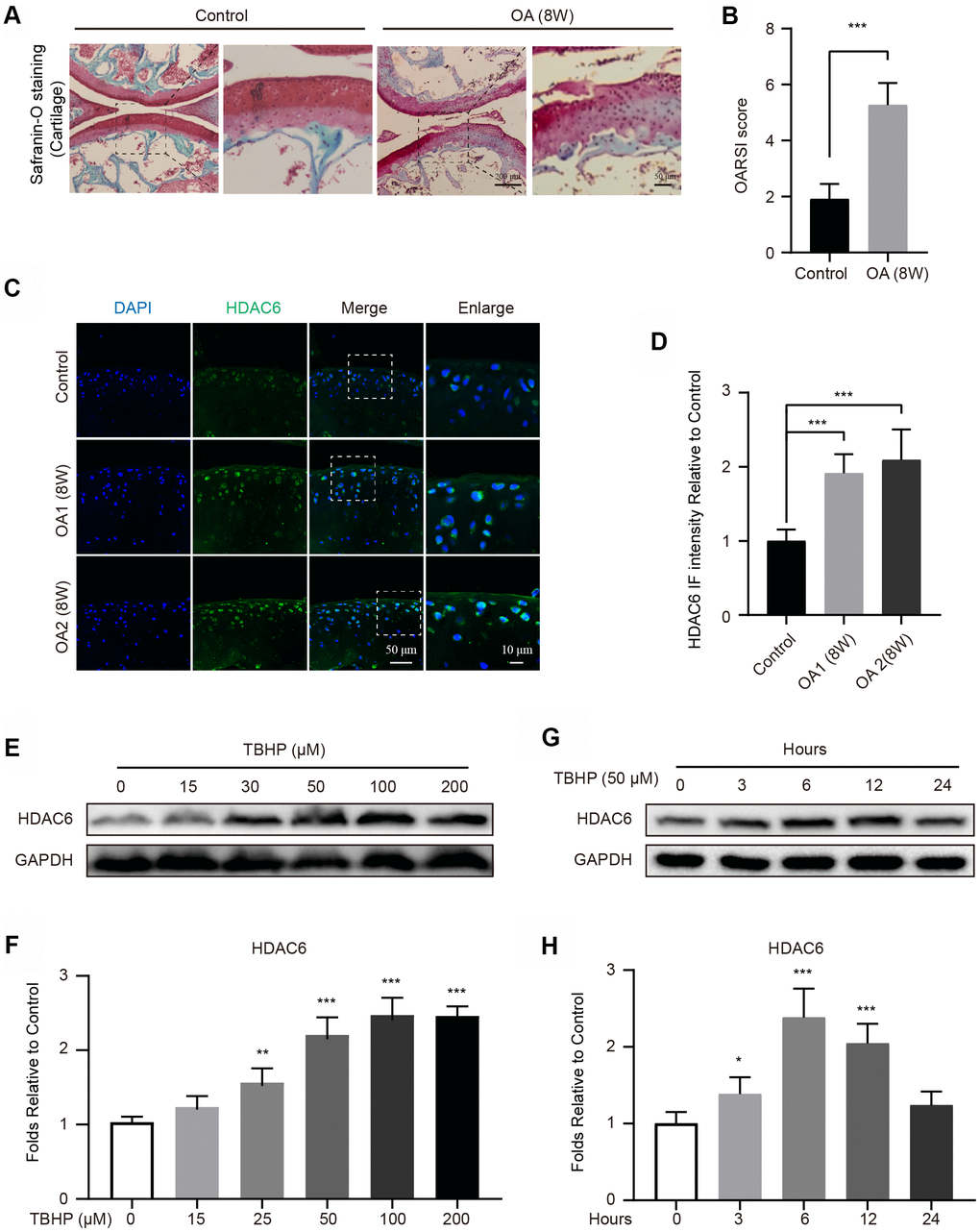 Upregulation of HDAC6 in mouse knees and chondrocytes. (A, B) Typical Safranin O staining of the cartilage and subchondral cortical bone in each group of mice, scale bar = 200 μm, scale bar (enlarged) = 50 μm. (C, D) IF staining and quantification of the changes in HDAC6 in control and OA mice, scale bar = 50 μm, scale bar (enlarged) = 10 μm. (E, F) Western blotting and quantification of HDAC6 in chondrocytes subjected to different concentrations of TBHP for 12 hours. (G, H) Western blotting and quantification of HDAC6 in chondrocytes subjected to 50 μM of TBHP in a time-dependent manner. N = 5, GAPDH was the loading control, significance: *P