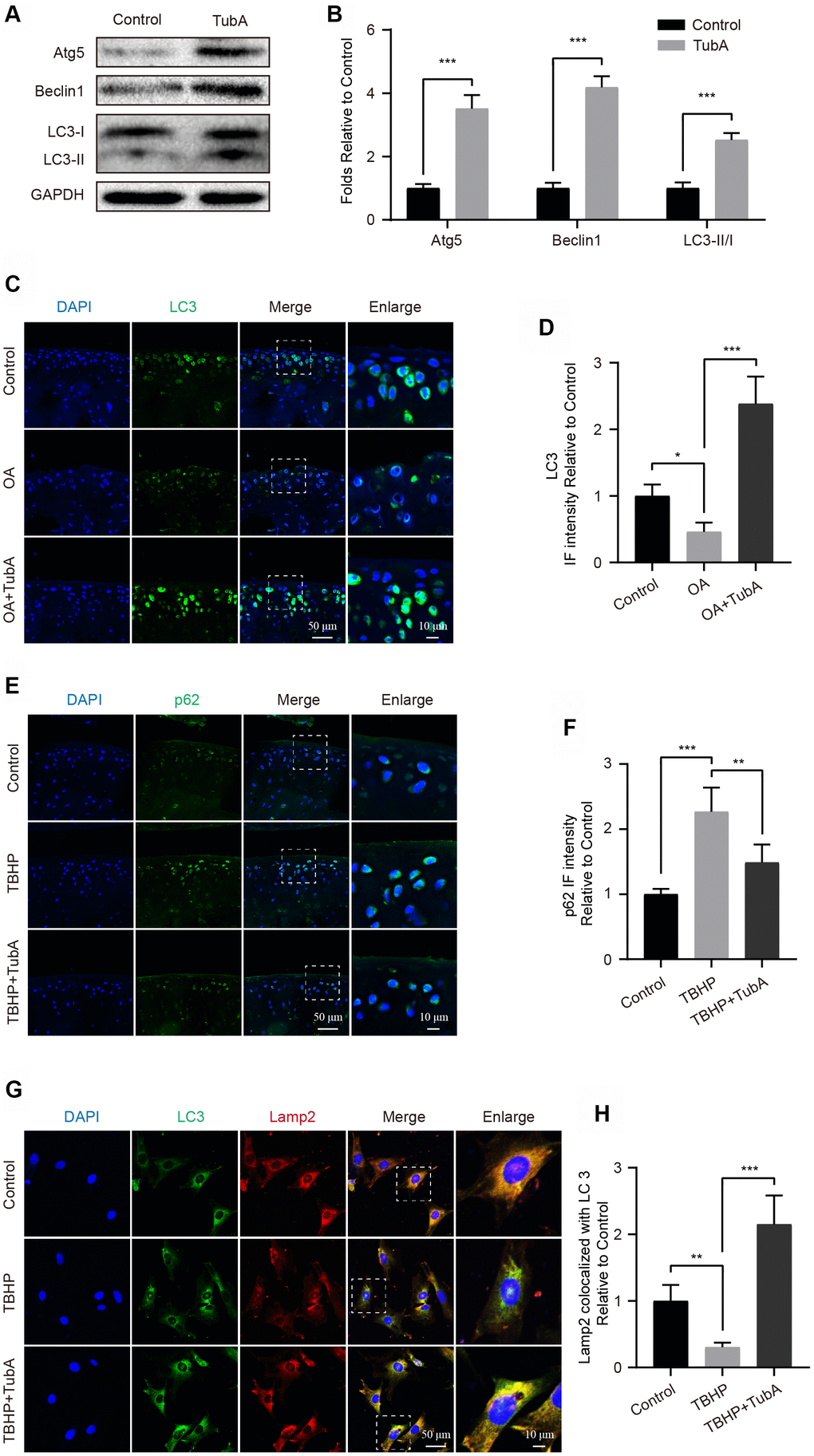 Inhibition of HDAC6 by TubA activates autophagy. (A, B) Western blotting and quantification of autophagic markers in each group. Chondrocytes were treated with TubA for 6 hours. (C, D) IF staining and quantification of LC3 in each mouse group, scale bar = 50 μm, scale bar (enlarged) = 10 μm. (E, F) IF staining and quantification of p62 in each mouse group, scale bar = 50 μm, scale bar (enlarged) = 10 μm. (G, H) Chondrocytes were treated with TBHP, TBHP + TubA for 6 hours, the co-localization of LC3 (green) and Lamp2 (red) were captured by IF staining and quantitatively analysed, scale bar = 50 μm, scale bar (enlarged) = 10 μm. N = 5, GAPDH was the loading control, significance: *P