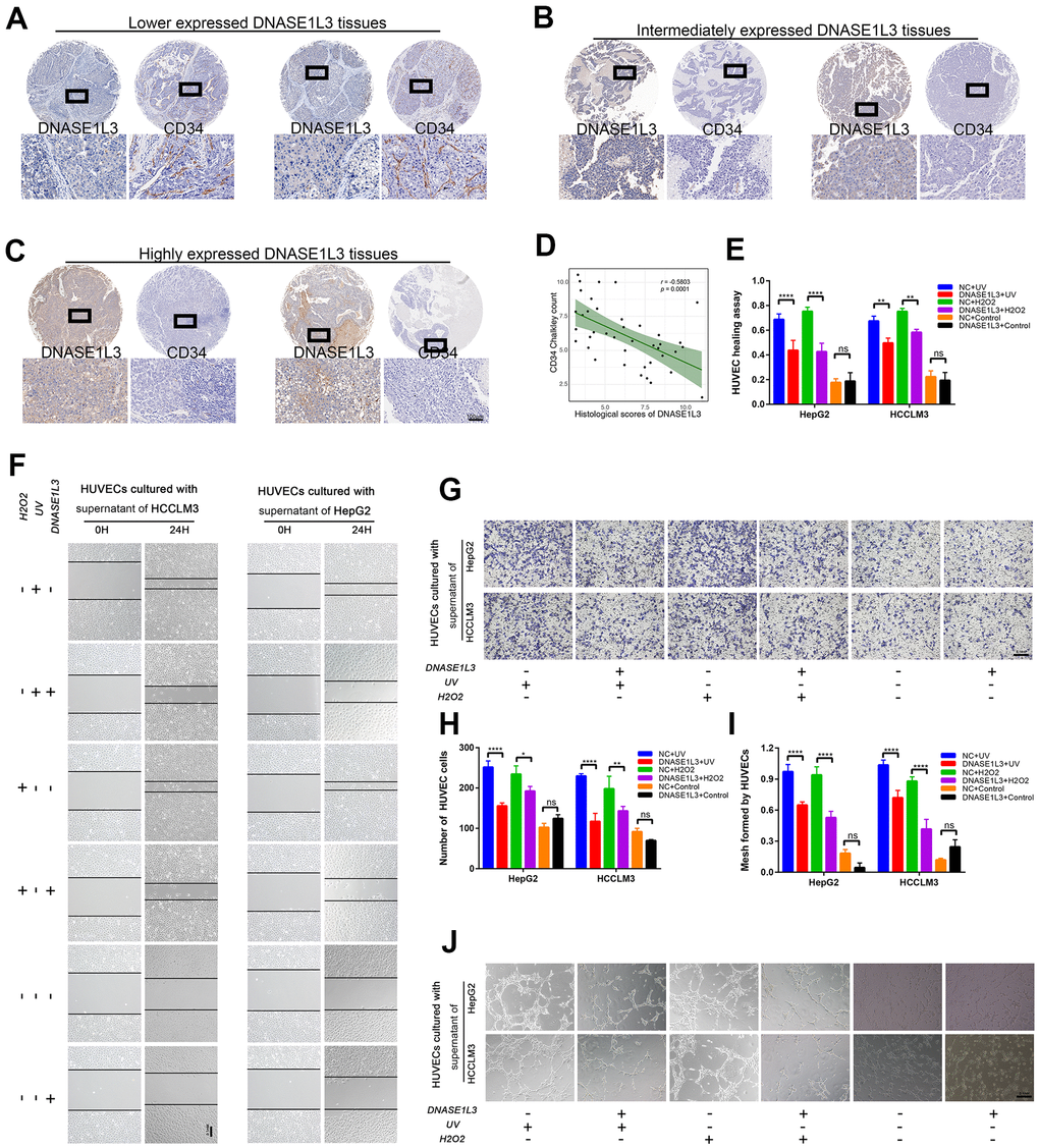 DNASE1L3 impairs angiogenesis through the differential expression of SASP under DDR activation. (A) Tissue microarray was stained with anti-DNASE1L3 and anti-CD34 antibody, low expression of DNASE1L3 was considerably associated with cancer vasculature invasion. (scale bar, 100 μm). (B, C) Tumor tissues of DNASE1L3 intermediately or highly expressed were observed to be linked with lower vasculature invasion. (scale bar, 100 μm). (D) The histological scores of DNASE1L3 and the CD34 Chalkley counts in HCC tissues was analyzed and showed a significant negative association. (E, F) The motility of HUVECs were assessed by wound healing assay, the supernatants from cells in differently treated groups were added into the culture of HUVECs, images were taken at 0h and 24h (scale bar, 100 μm). (G, H) The cellular migration ability of HUVECs were determined by the transwell migration assay. The supernatants from cells in differently treated groups were added into the lower chamber, images were taken after 24h of incubation (scale bar, 100 μm). (I, J) The tube formation ability of HUVECs were determined by tube formation assay. The supernatants from cells in differently treated groups were added into the culture, images were taken after 6h of incubation (scale bar, 100 μm). The results show the means ± SD from at least three separate experiments.