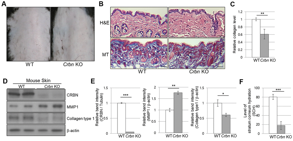 The mice ablated CRBN gene exhibits decreased levels of skin hydration. (A) The appearance of the back skin to compare the control WT and CRBN KO groups, respectively. (B) Relative initial Stratum Corneum Hydration (SCH) level in the skin of control WT and CRBN KO mouse skin. (C) Representative image of H&E and Masson’s trichrome stained section showing the structure of the epidermis and the dermis from the back skin of 12-weeks old female mice. (D) Analysis of the level of collagen fibers in the skin section in (C). (E) Western blots analysis using the protein lysate from the mouse skin. Proteins were subjected to immunoblotting using the anti-CRBN, anti-MMP1, anti-Collagen type1, and β-actin antibodies. The β-actin was used as a loading control. (F) Relative band intensities determined by densitometric-analysis of each protein in blot (E). The results shown are representative images of independent experiments (n=5). Scale bar = 100μm. *P P P 