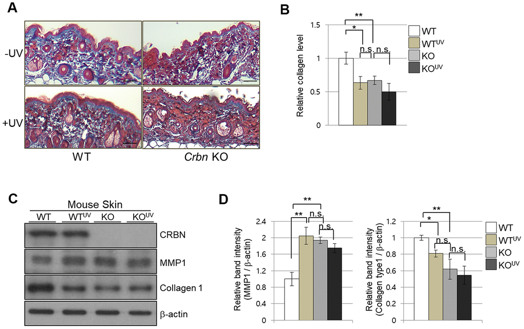 The absence of CRBN in mice skin mimics UV-damaged phenotype. (A) Representative image of Masson’s trichrome stained section showing the skin structure affected by ultraviolet irradiation after 4 weeks. (B) Analysis of the level of collagen fibers in the skin section in (A). (C) Western blots analysis using the protein lysate from the mouse skin. Proteins were subjected to immunoblotting using the anti-CRBN, anti-MMP1, anti-Collagen type1, and β -actin antibodies. The β-actin was used as a loading control. (D) Relative band intensities determined by densitometric-analysis of each protein in blot (C). The results shown are representative images of independent experiments (n=5). Scale bar = 100μm. *P P P 