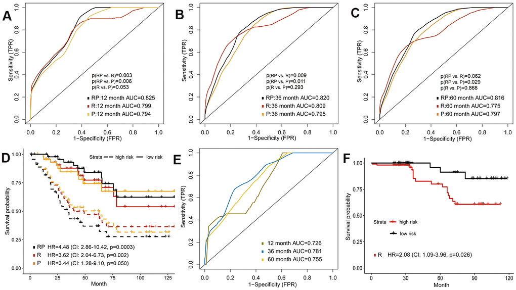 Predictive models of survival integrating radiomics with proteomics features. (A–C) Area under the ROC of radiomics features (R), protein expression (P) and combination of radiomics and proteomics (RP) for predicting survival in validation set. (D) Kaplan-Meier curves of the validation set that predicted patients’ survival by above models. (E) Predictive ability of radiomics model in external validation set. (F) Kaplan-Meier curves of external validation set analyzed with the radiomics model.